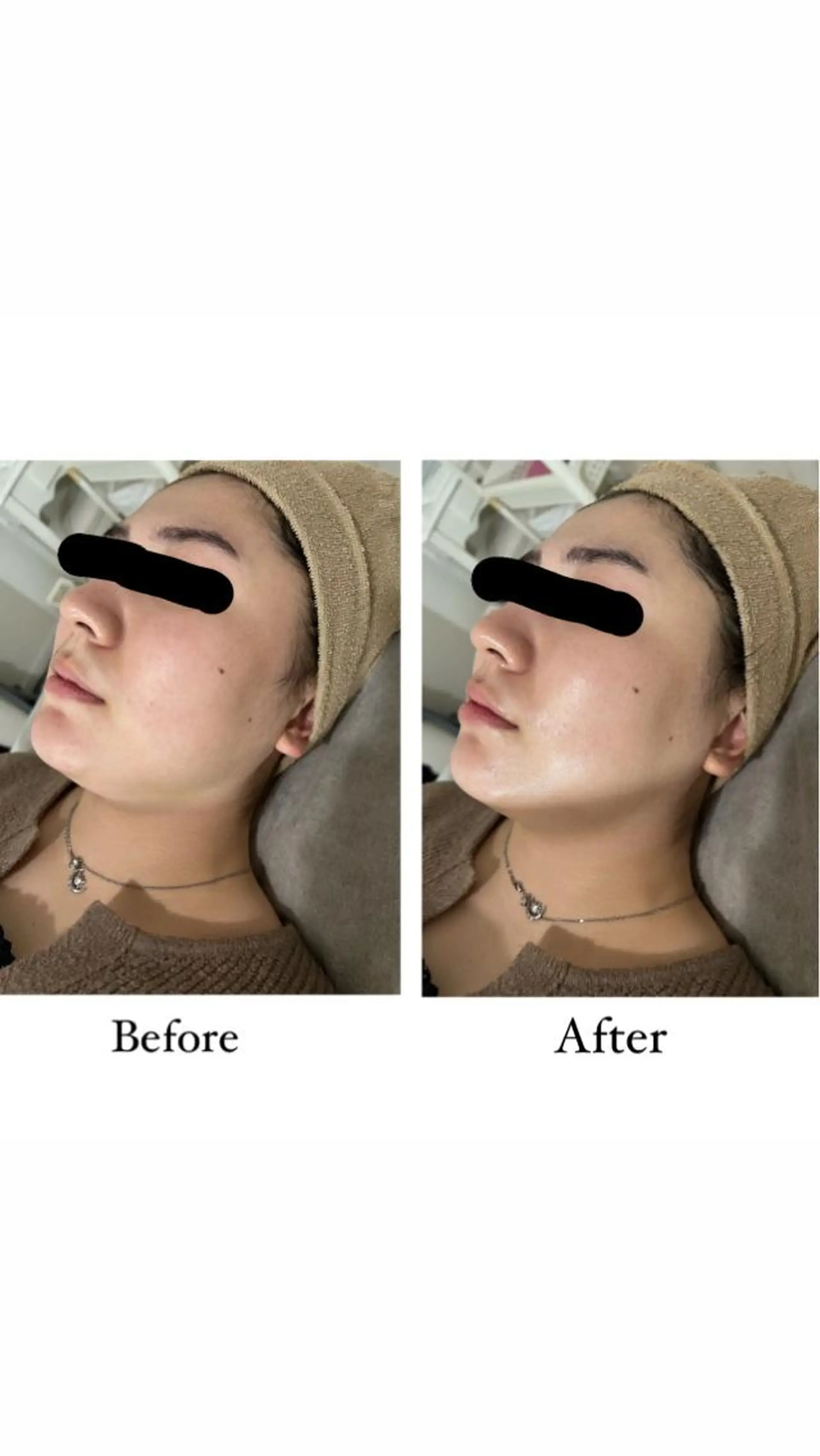 脱毛＆Beauty salon IILA所属・肌管理/HBL専門店 Sakuraの眉毛・アイブロウイメージ