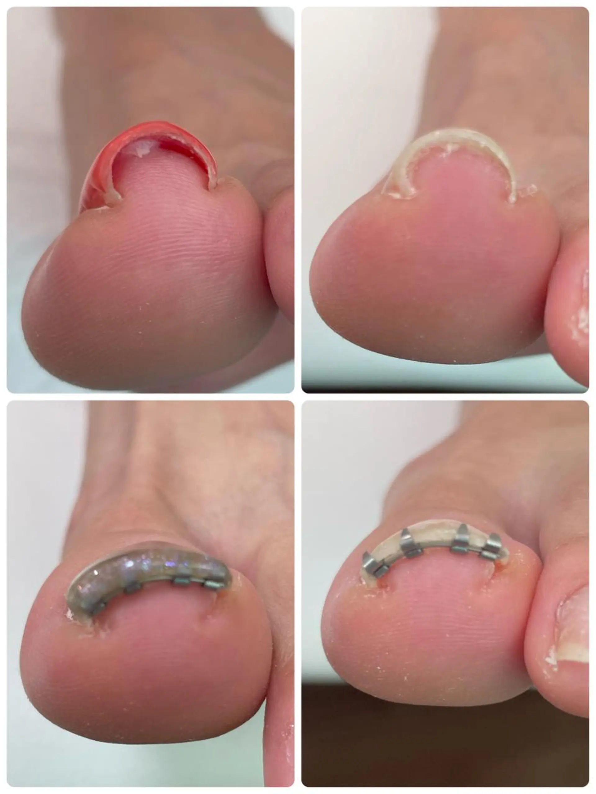 ネイル フットネイル Nail salon_Kのネイルデザイン