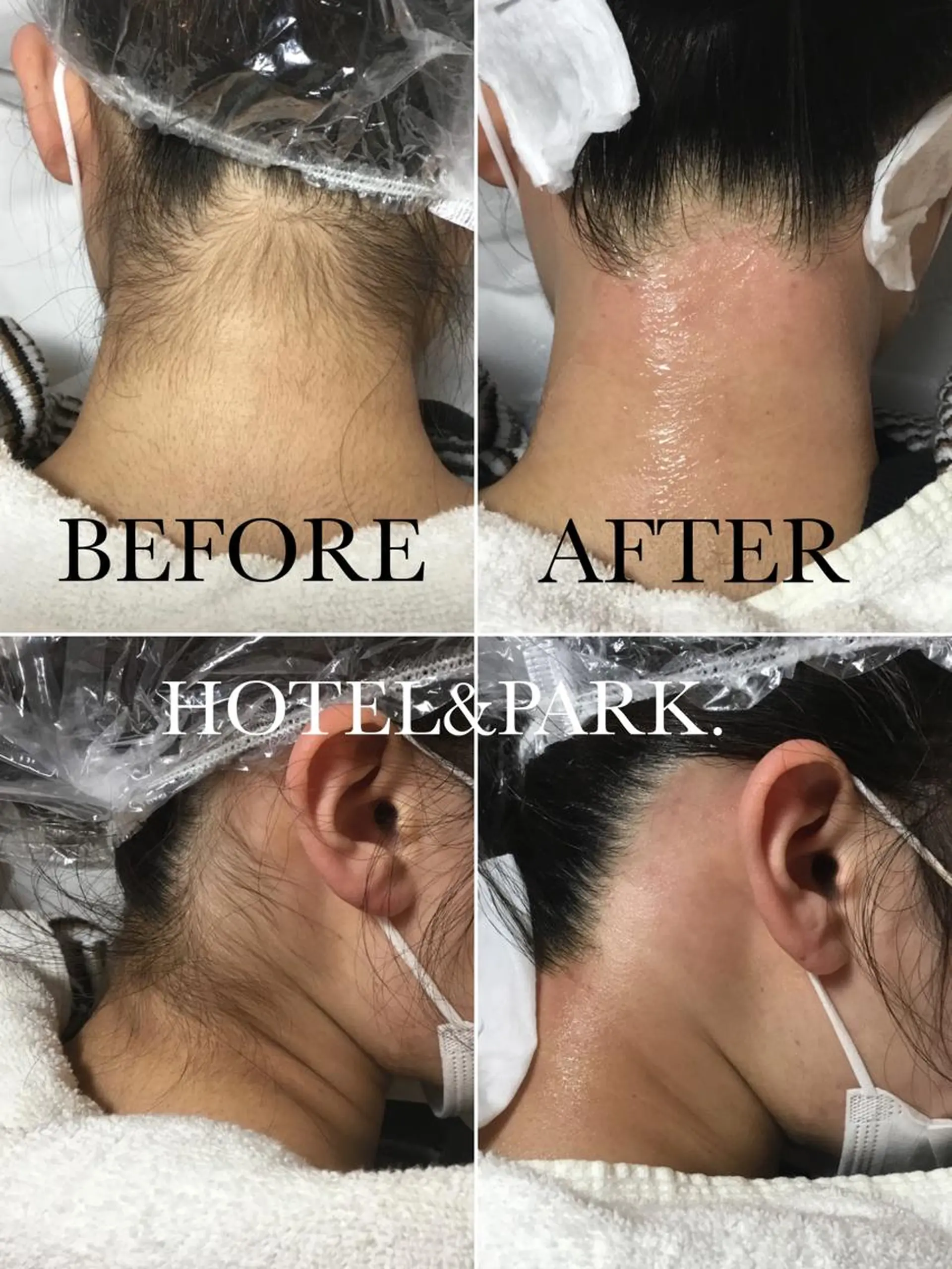 HOTEL&PARK . ワックス脱毛のエステ・リラクイメージ