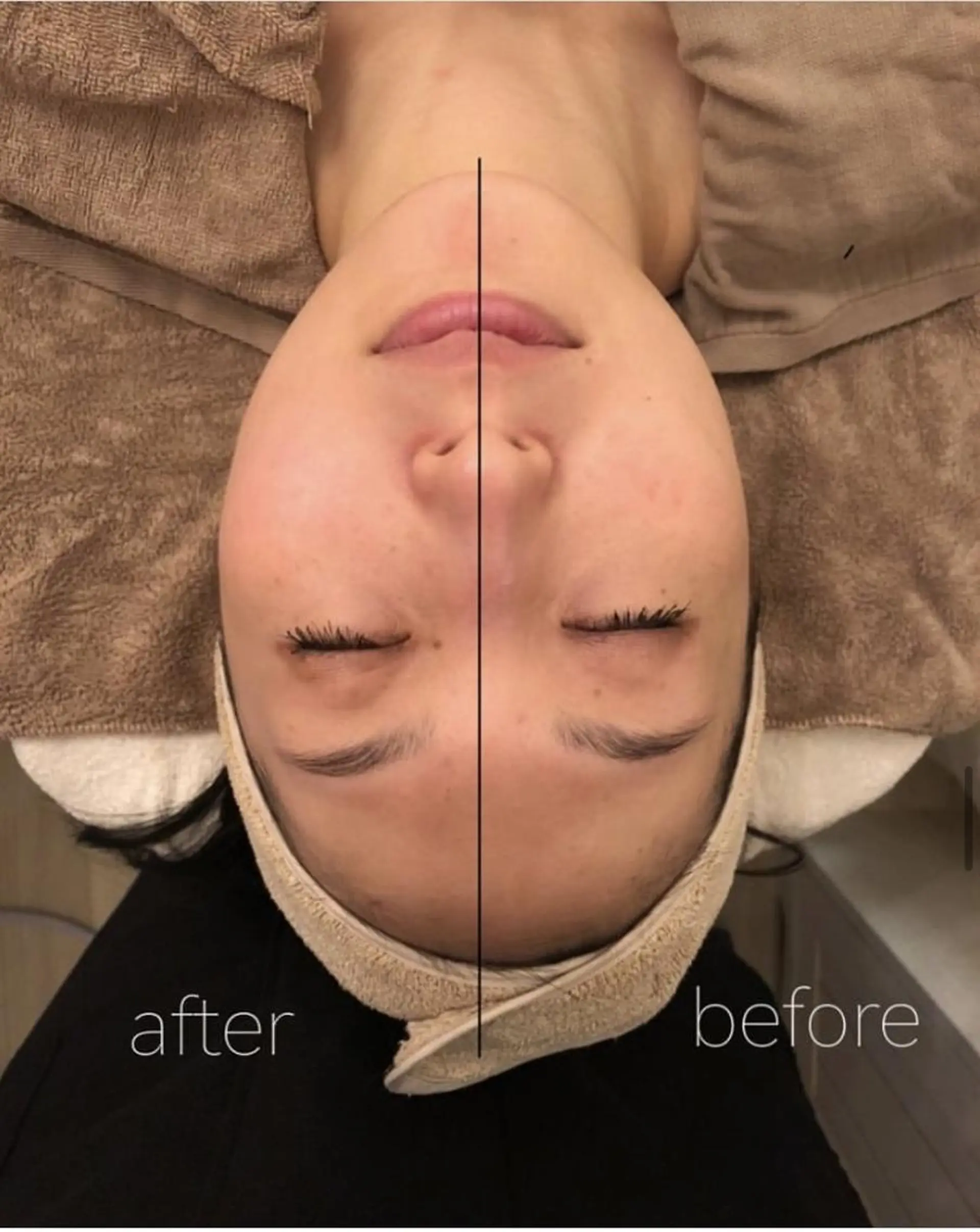 ✨美肌水光✨ アトリエリュバンのエステ・リラクイメージ