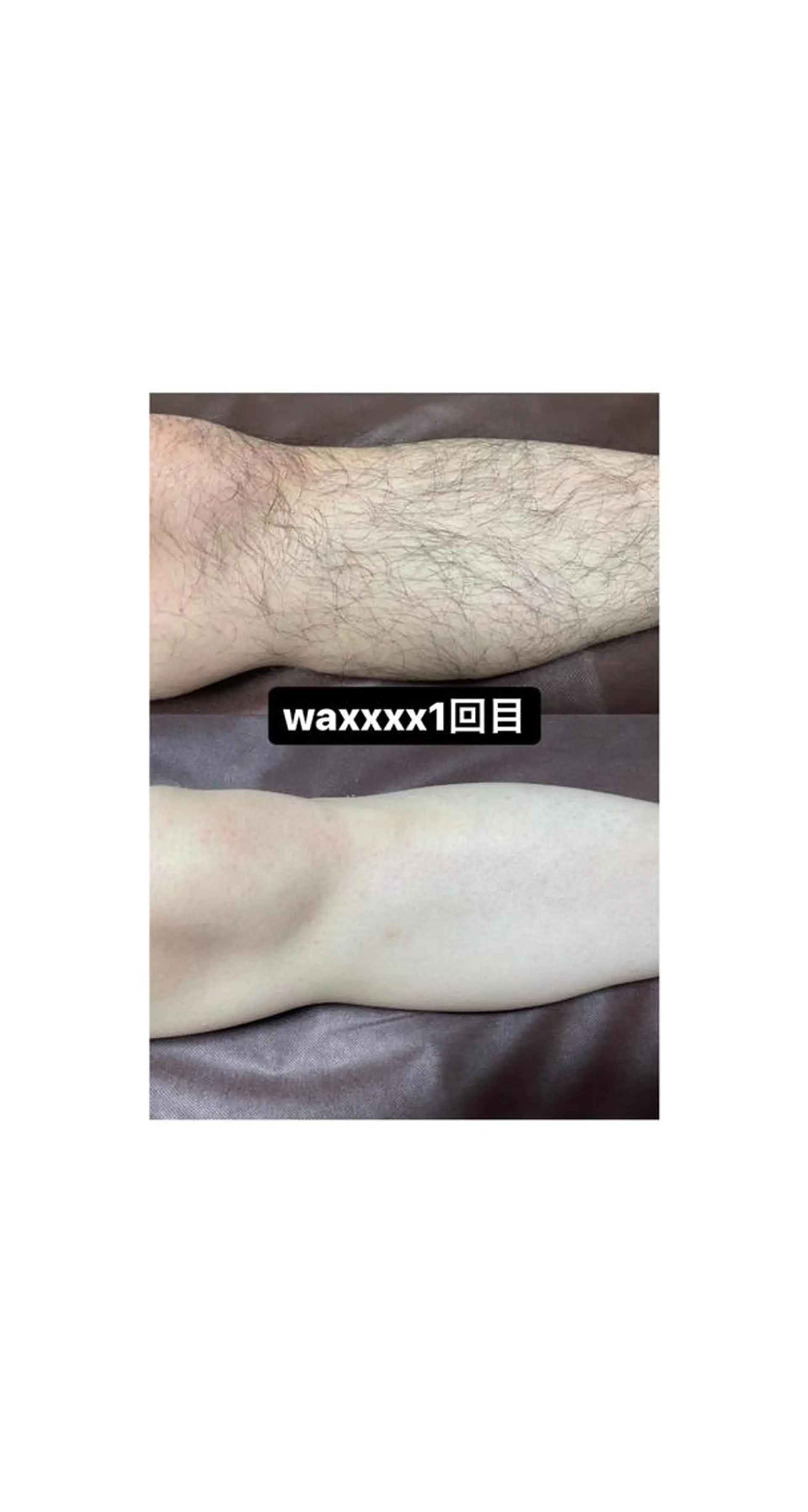 脱毛 Epina 千葉店 【エピナ】のエステ・リラクイメージ