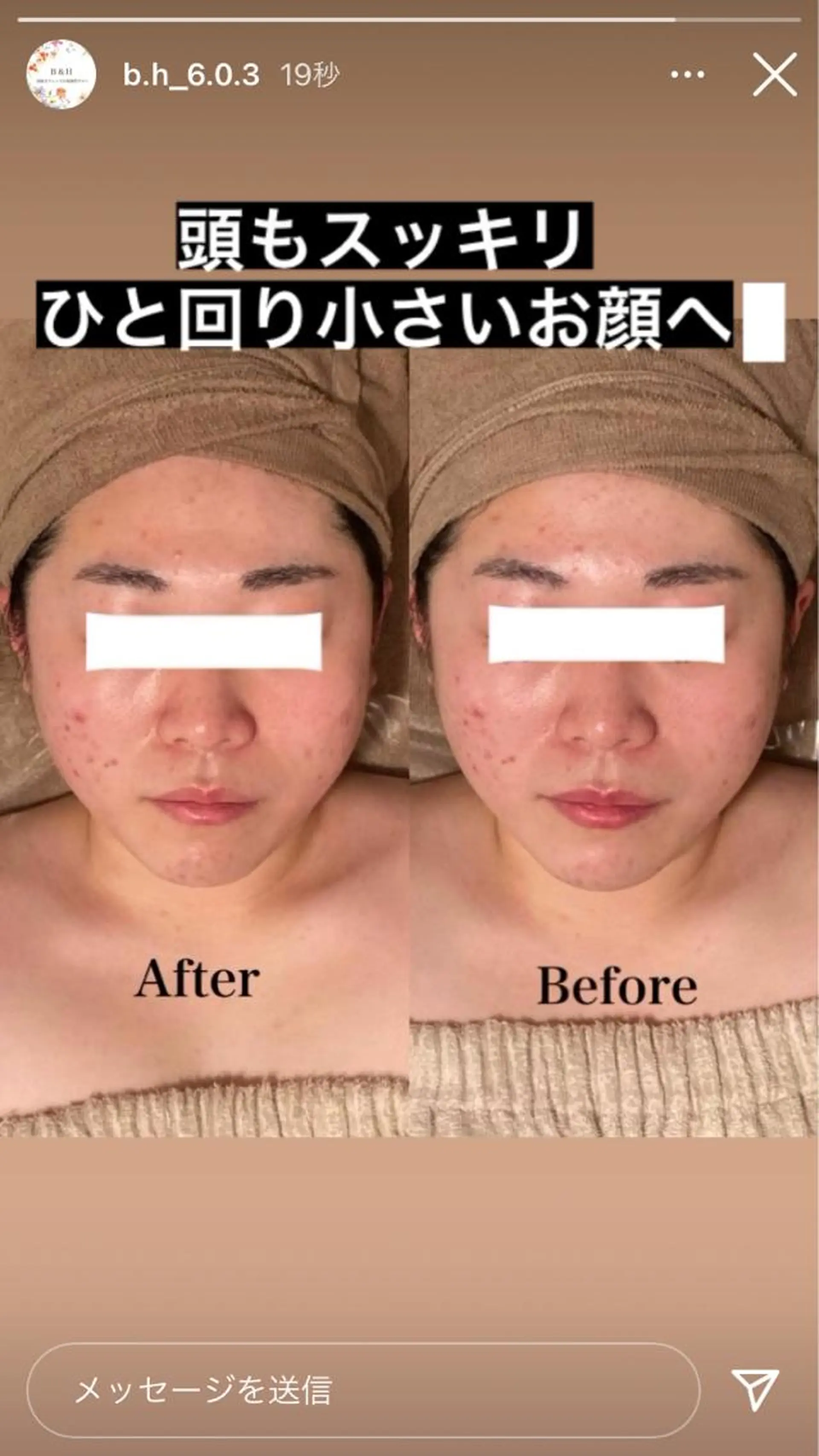 Ｂ&H所属・頭痛•肩こり専門/ 眉サロンB&H心斎橋のエステ・リラクイメージ