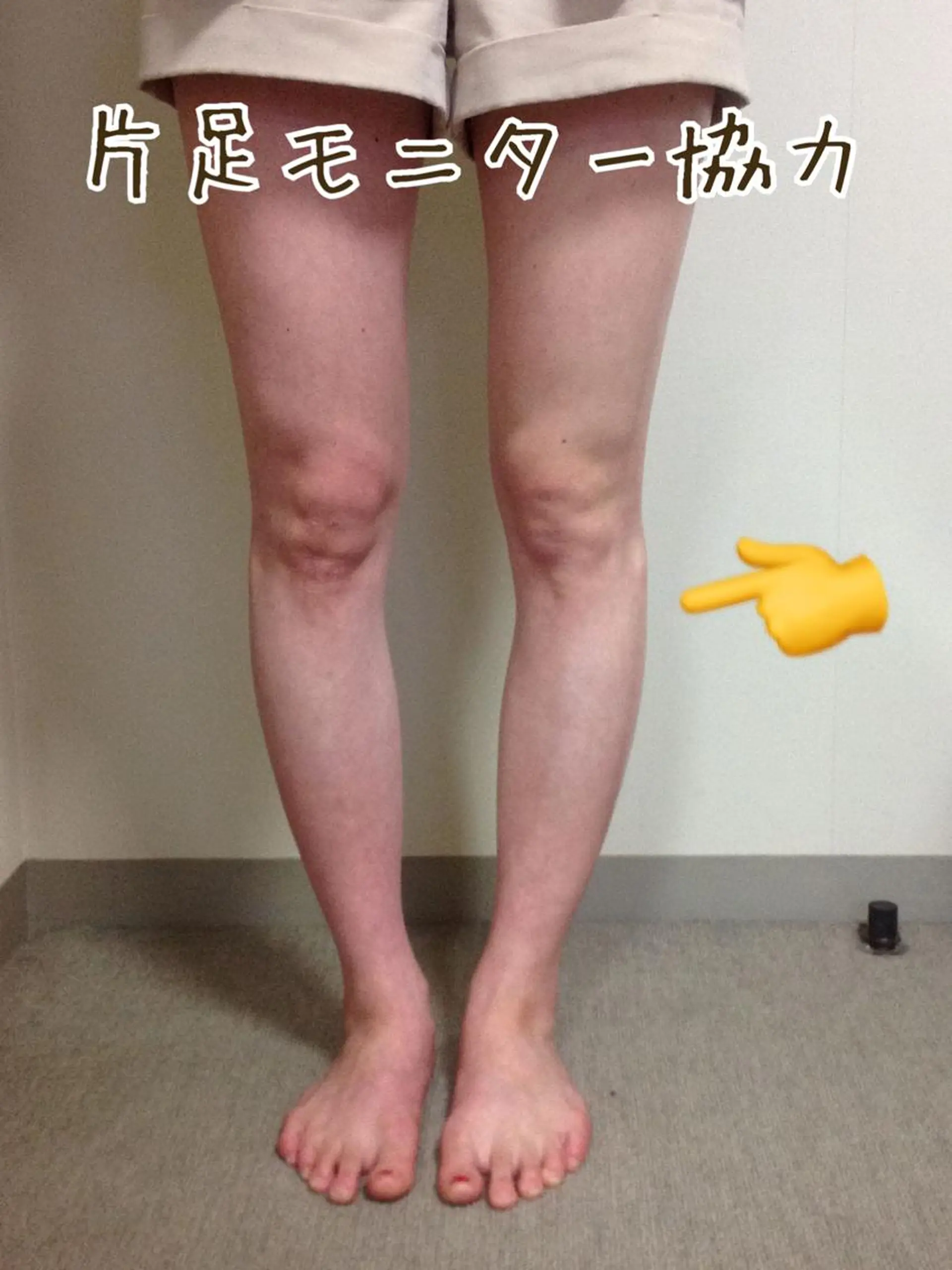 ニキビ・ 肌荒れ専門店のエステ・リラクイメージ