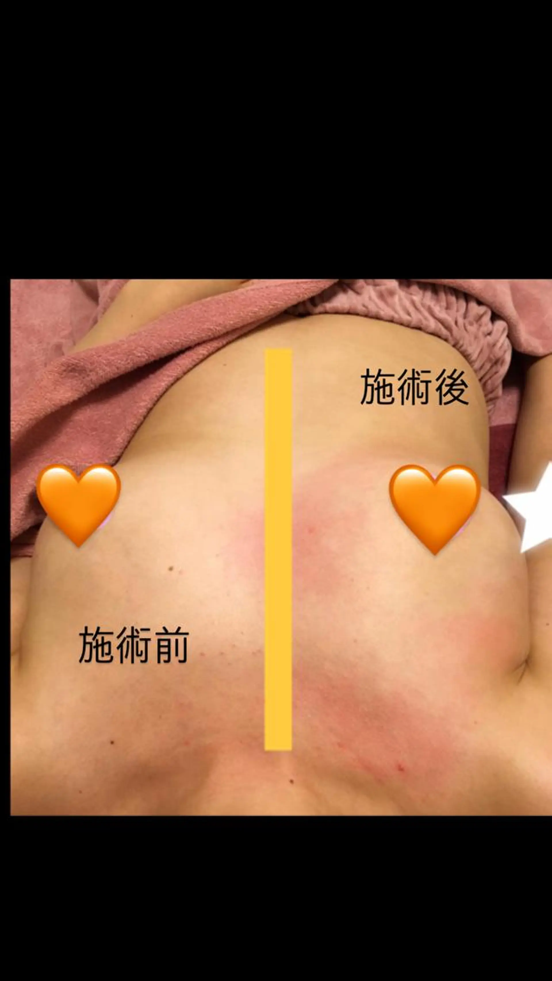 韓国系得意🦋 Aspire.のマツエク・マツパデザイン