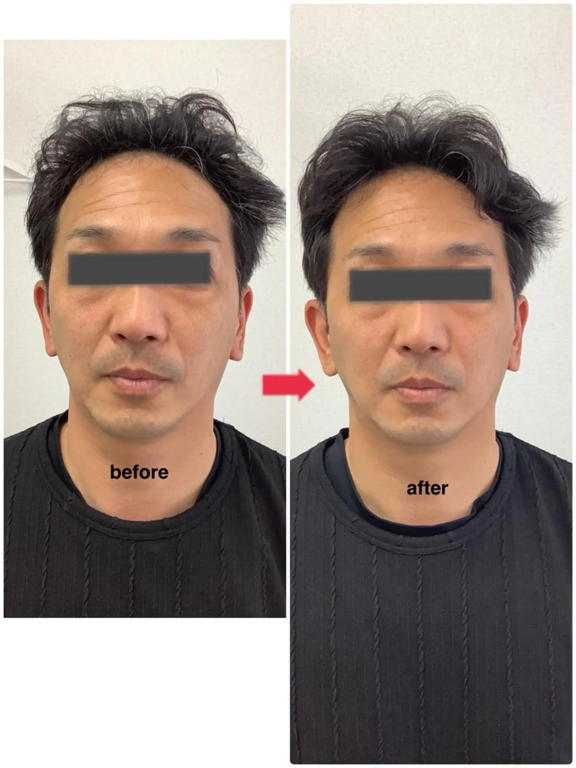 メディカルサロンドオフ所属・ハリサロンドオフ 美容鍼灸×小顔整体のエステ・リラクイメージ