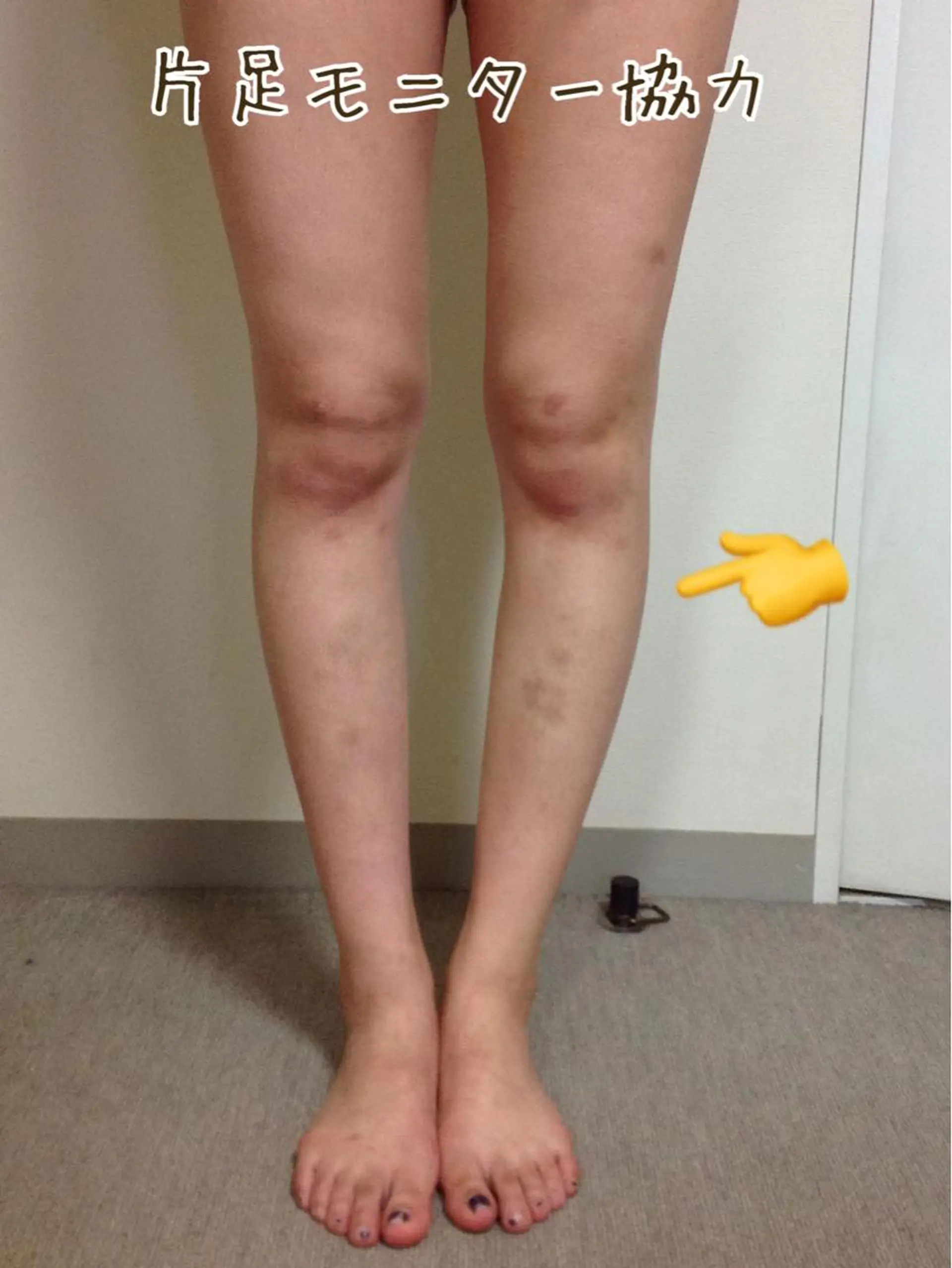 ニキビ・ 肌荒れ専門店のエステ・リラクイメージ