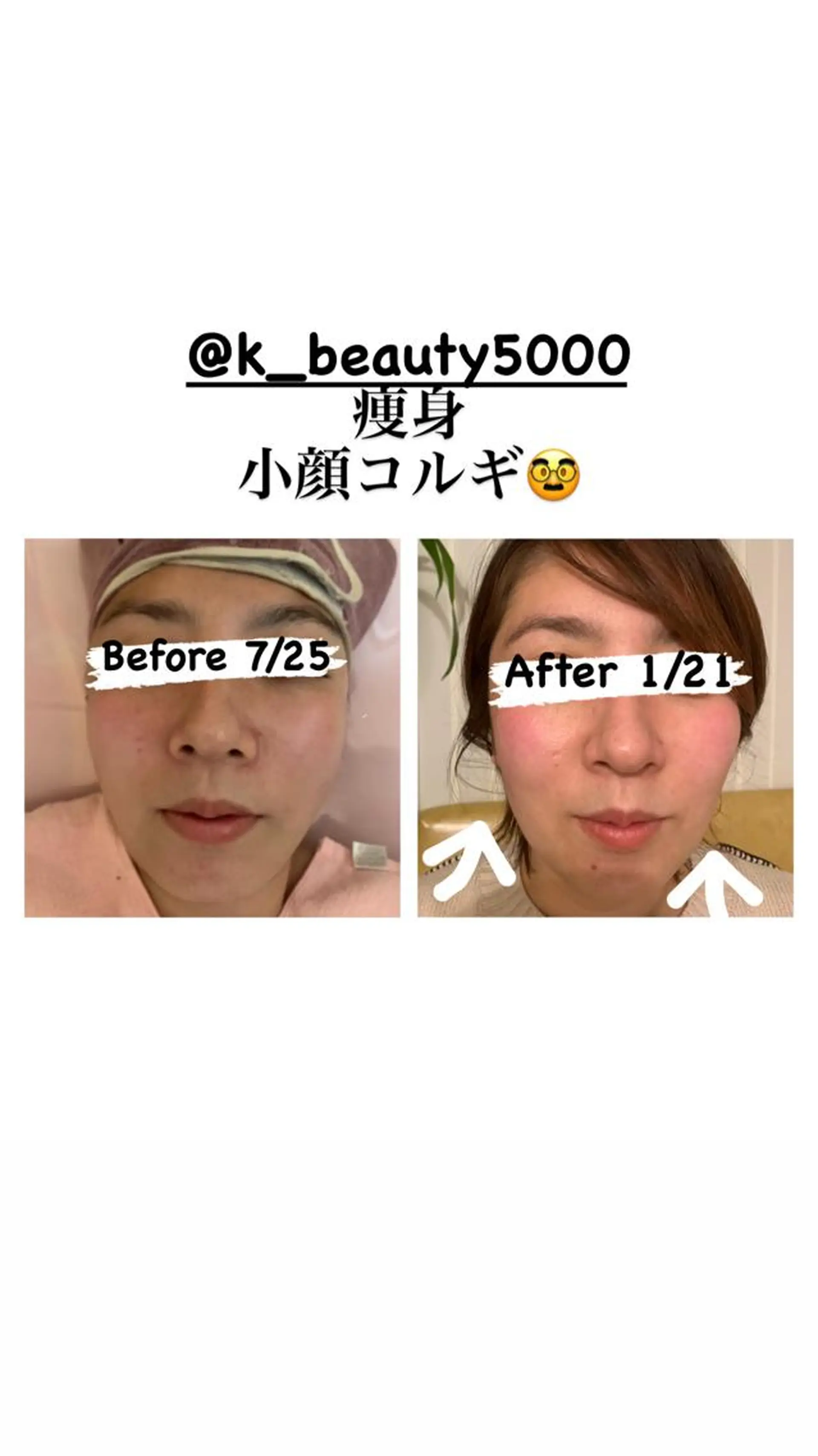 【ハイパーナイフ痩身&小顔コルギ&ハーブピーリング】K-Beauty　東新宿所属・kーbeauty小顔 コルギ&インディバのエステ・リラクイメージ