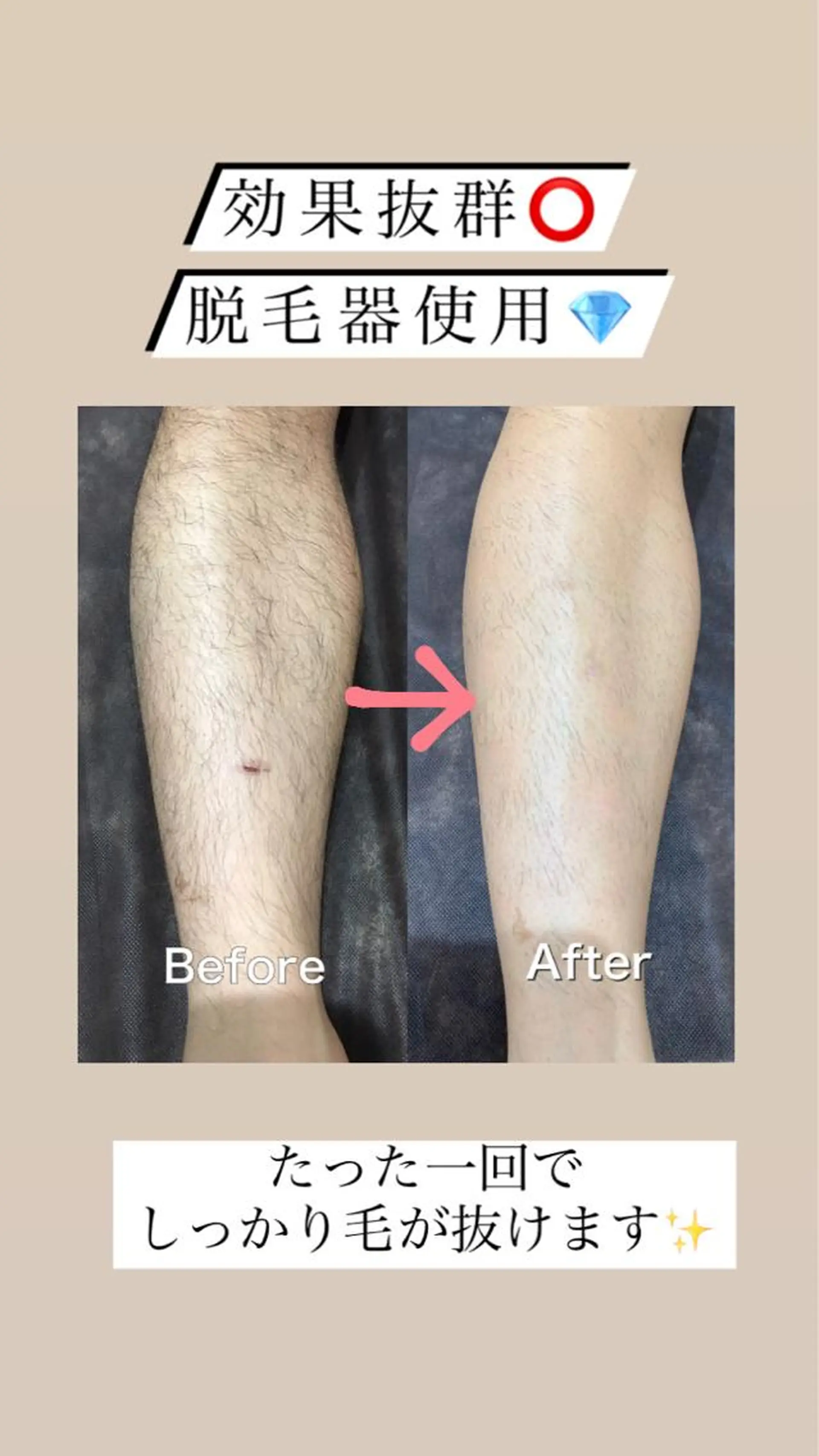 セミロング カラー パーマ ヘアアレンジ メンズ キッズ ネイル マツエク・マツパ アイブロウ Chloe-クロエ- 脱毛/フェイシャルのエステ・リラクイメージ