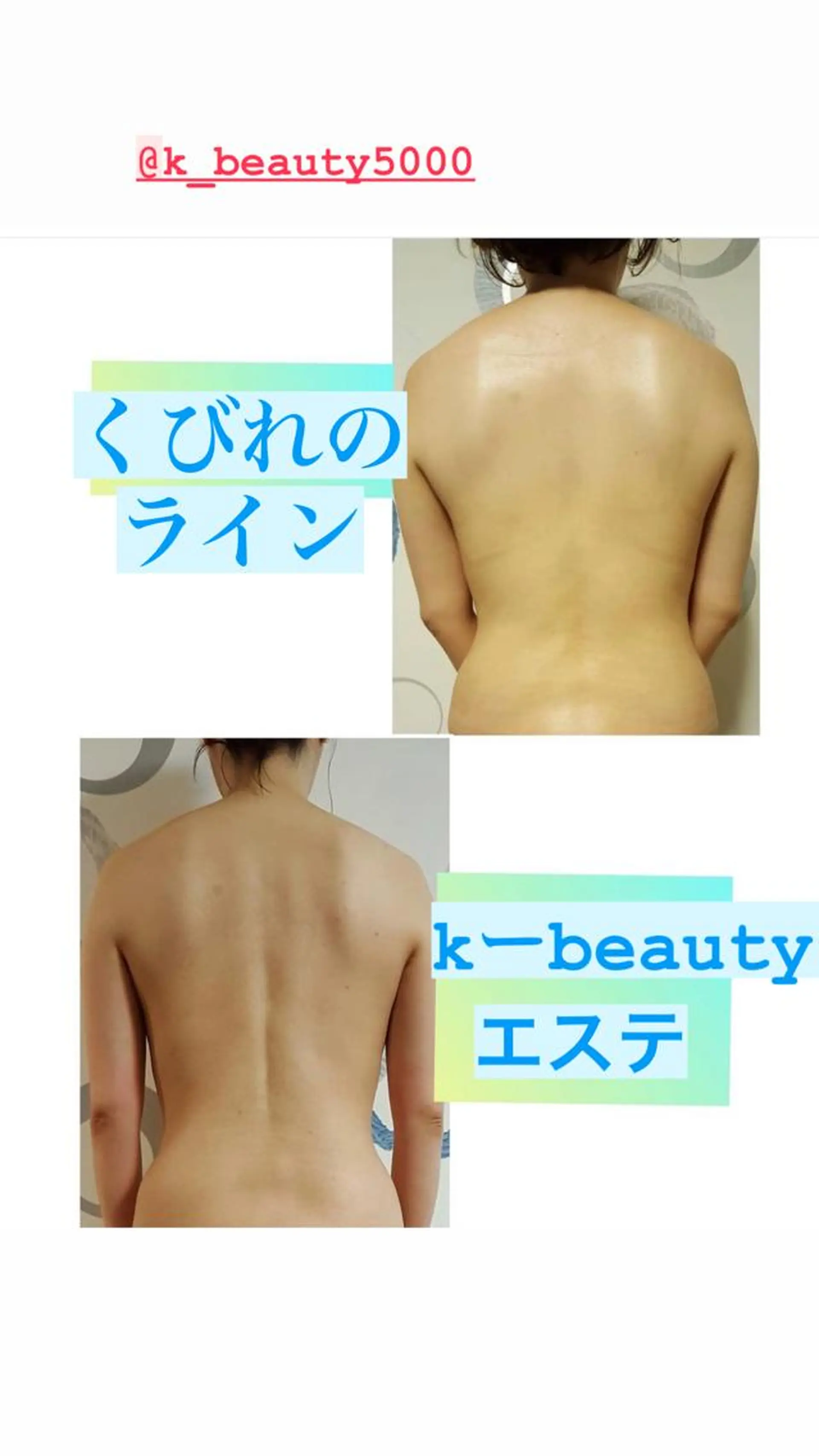 エステ リラク 【ハイパーナイフ痩身&小顔コルギ&ハーブピーリング】K-Beauty　東新宿所属・kーbeauty痩身 フェイシャルのエステ・リラクイメージ