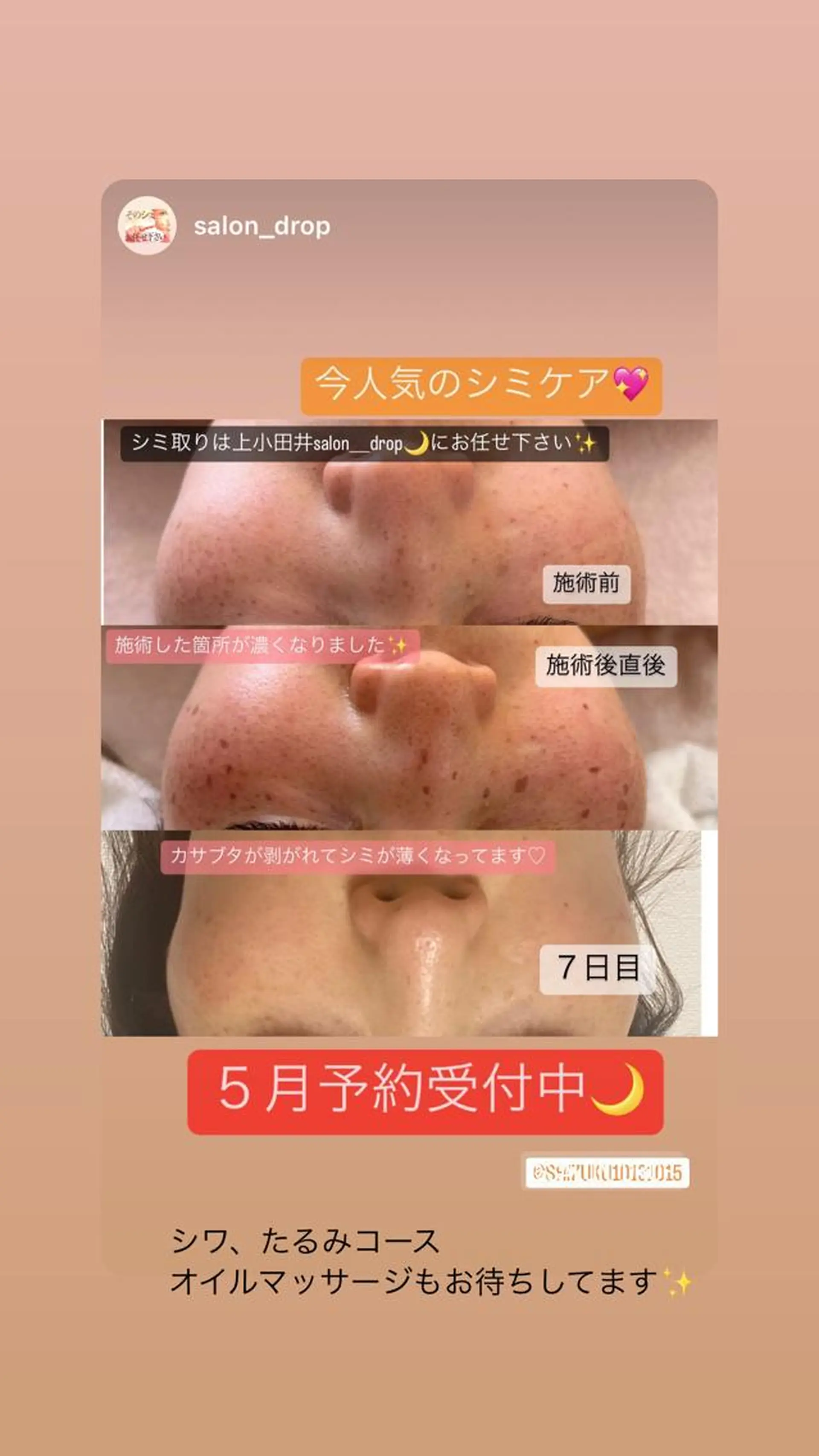 salon＿drop所属・salon dropのエステ・リラクイメージ