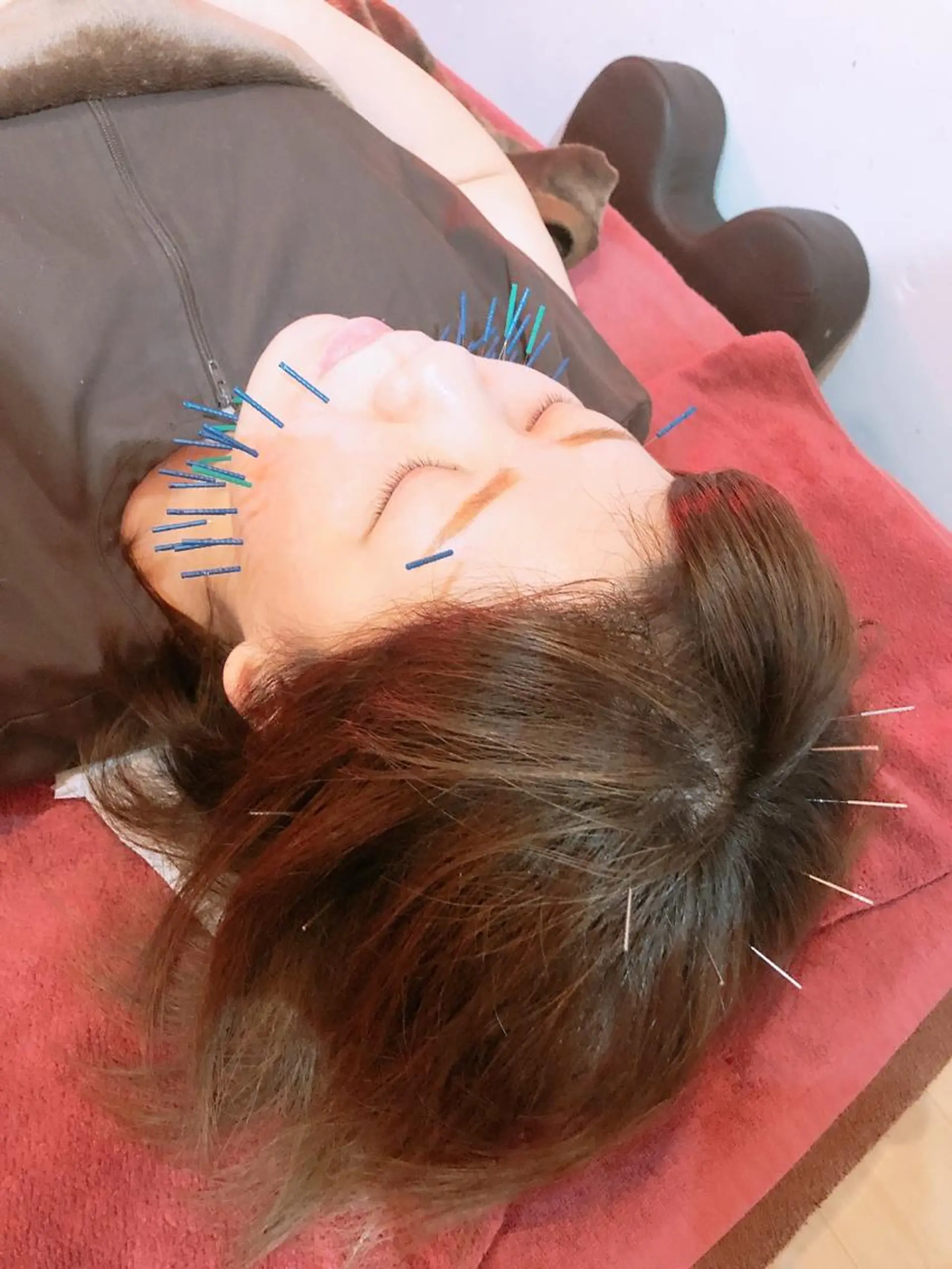 美容鍼灸女性専用 りんご鍼灸治療院のその他イメージ