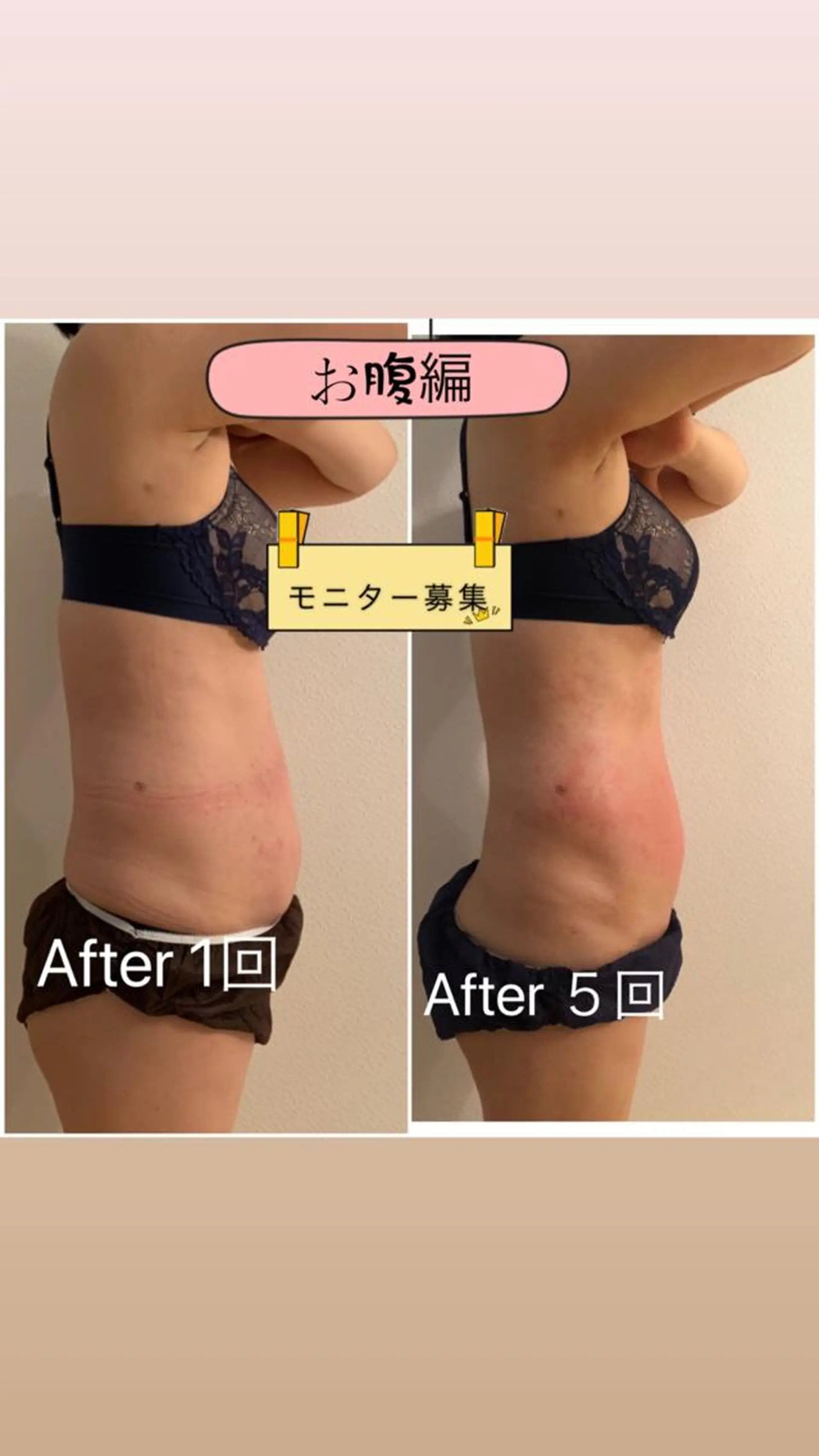 エステ リラク 【ハイパーナイフ痩身&小顔コルギ&ハーブピーリング】K-Beauty　東新宿所属・kーbeauty痩身 フェイシャルのエステ・リラクイメージ