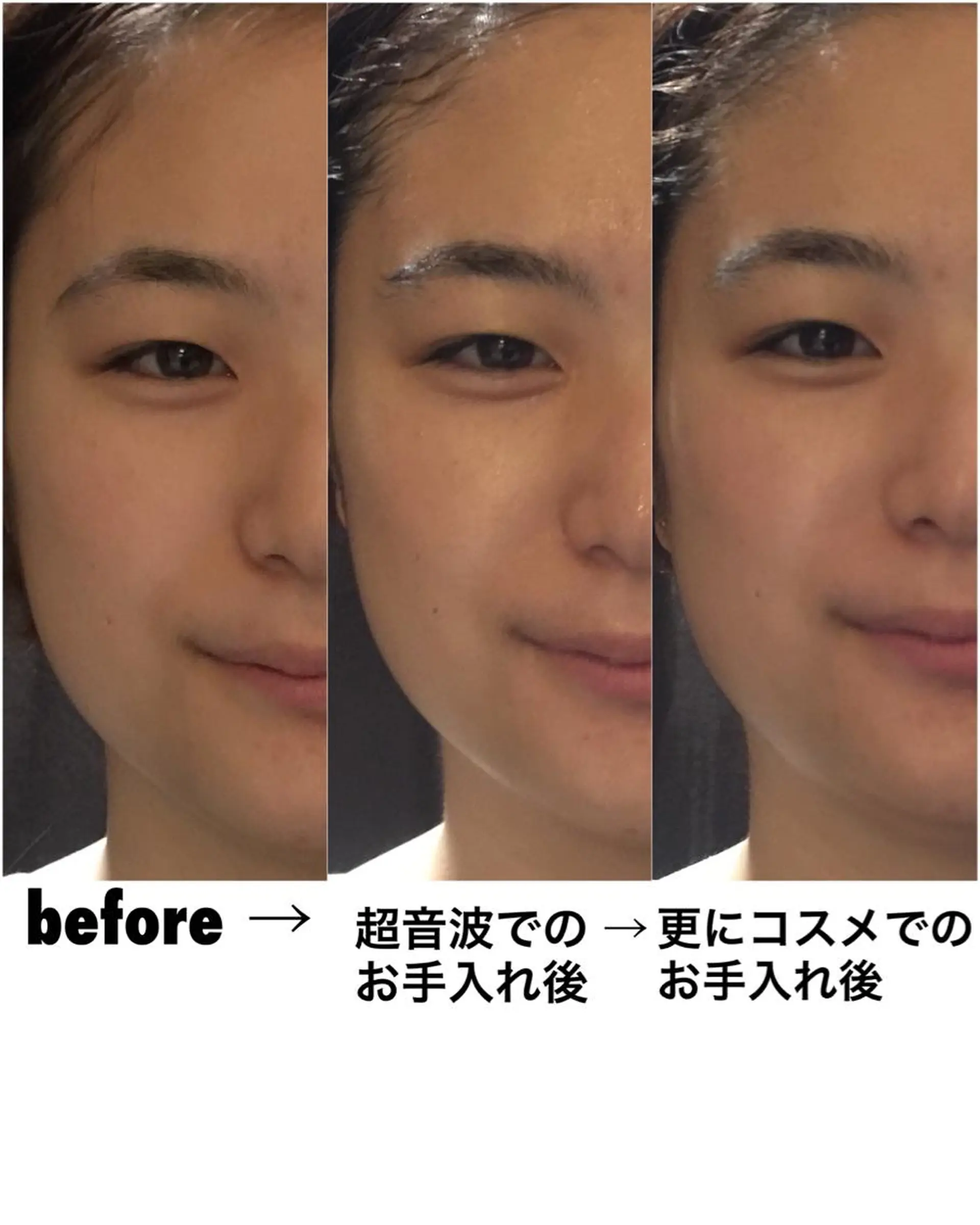 ﾘﾝﾊﾟｴｽﾃ 🌻ぷらすわん🌻のエステ・リラクイメージ