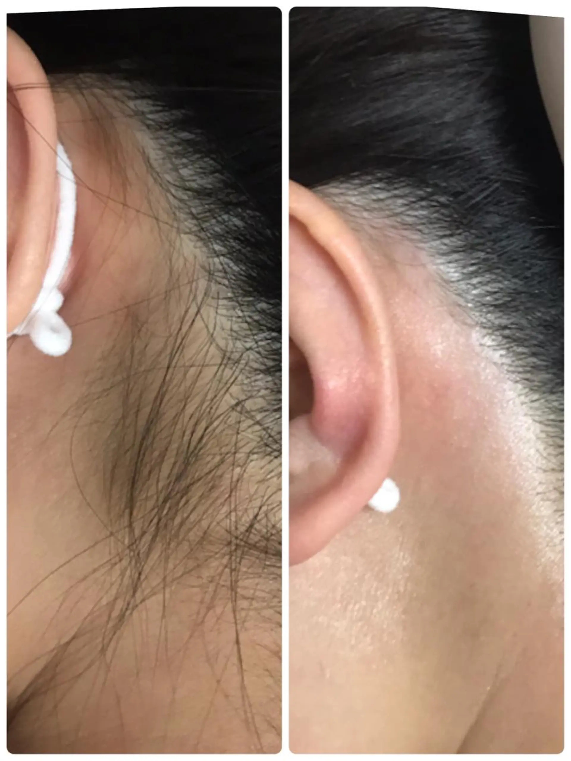 脱毛 MAKANA waxing&relaxation所属・MAKANA 吉岡 小岩店のエステ・リラクイメージ