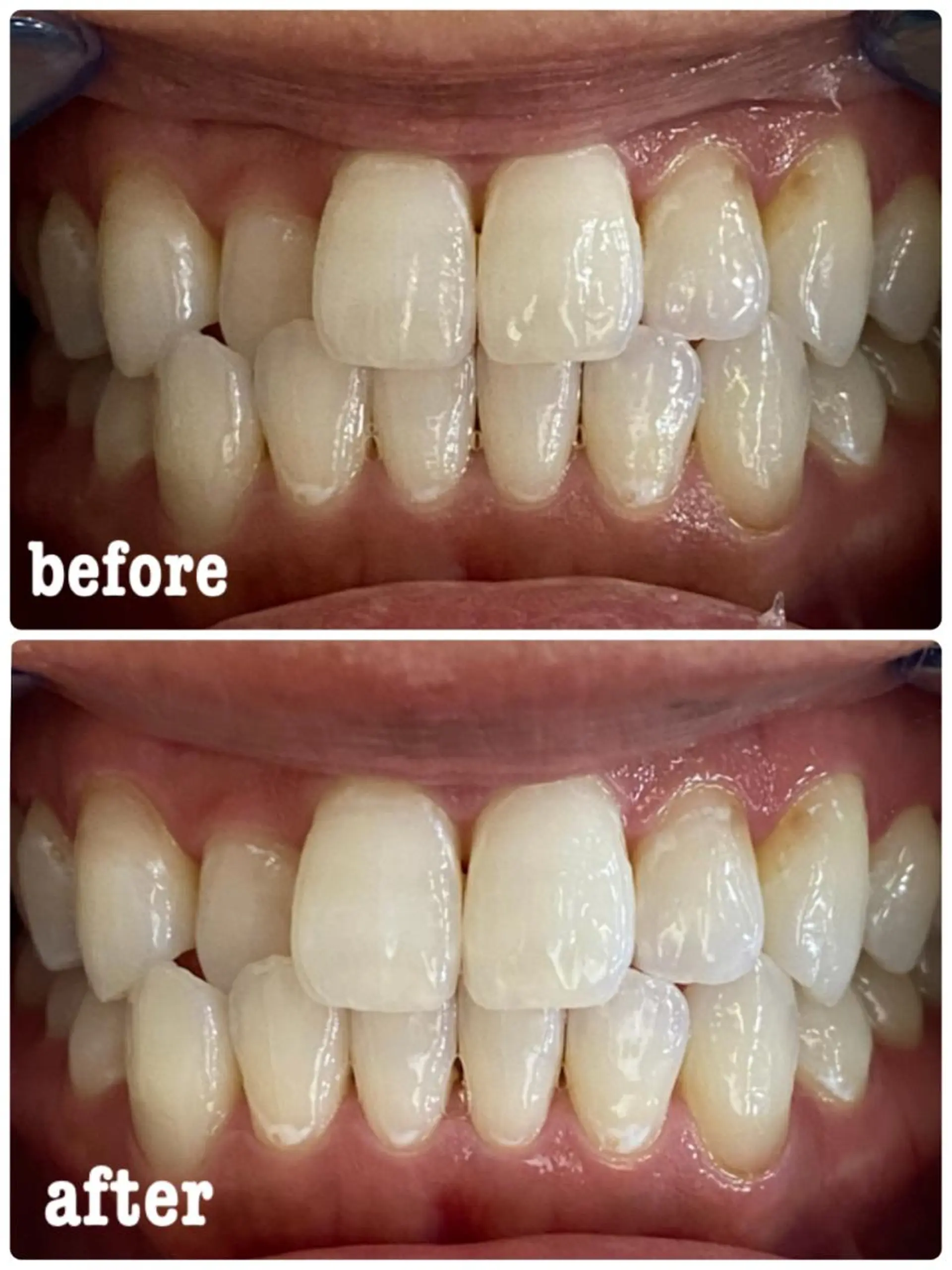 その他 ホワイトニングサロン ラウレアのその他イメージ