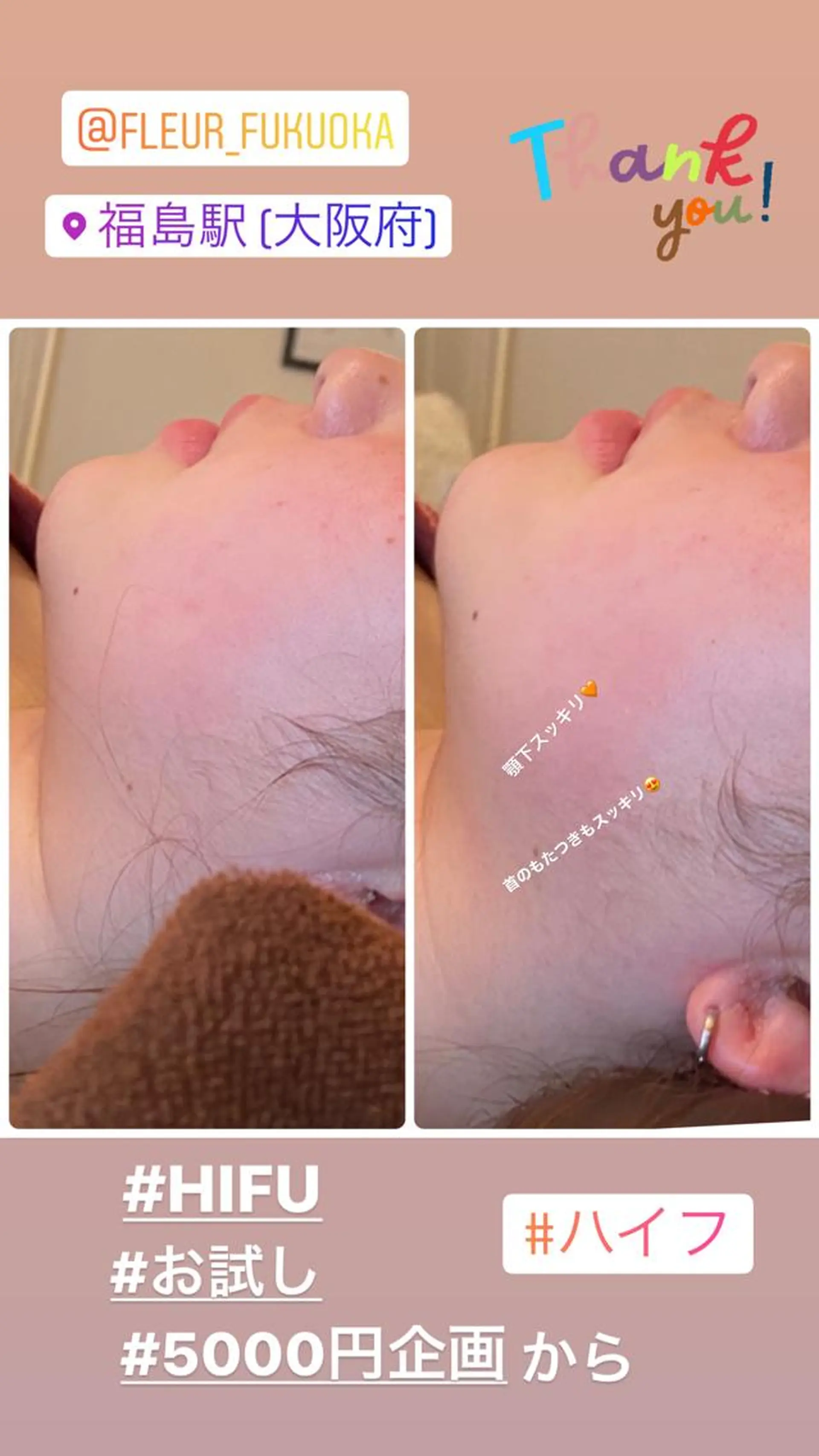 FLEUR大阪・整体 ・ハイフ・痩身・小顔のエステ・リラクイメージ