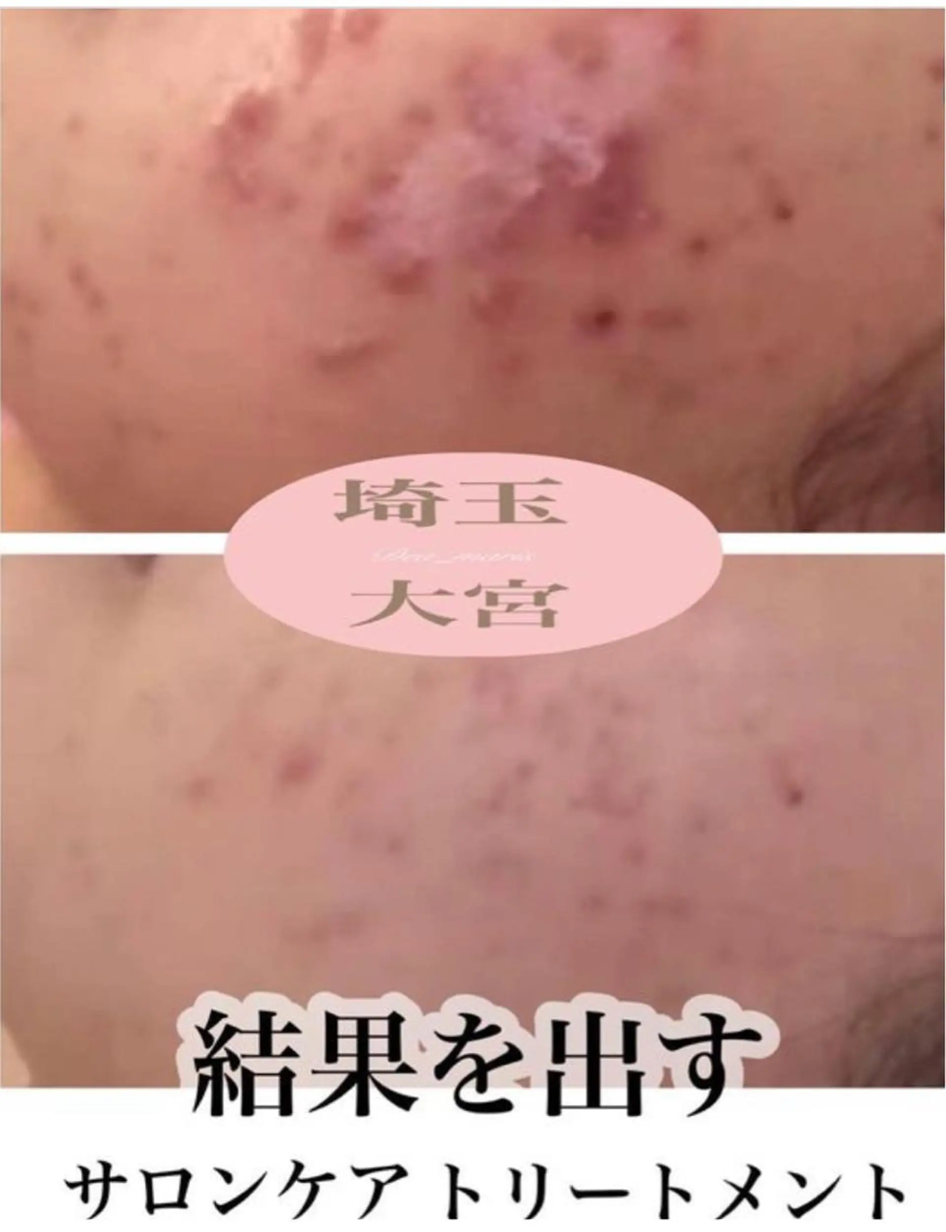 private salon  Dea_maris シュガーリング＆パーソナルボディケア所属・シミ改善・韓国肌管理 ボディメイク痩身のその他イメージ