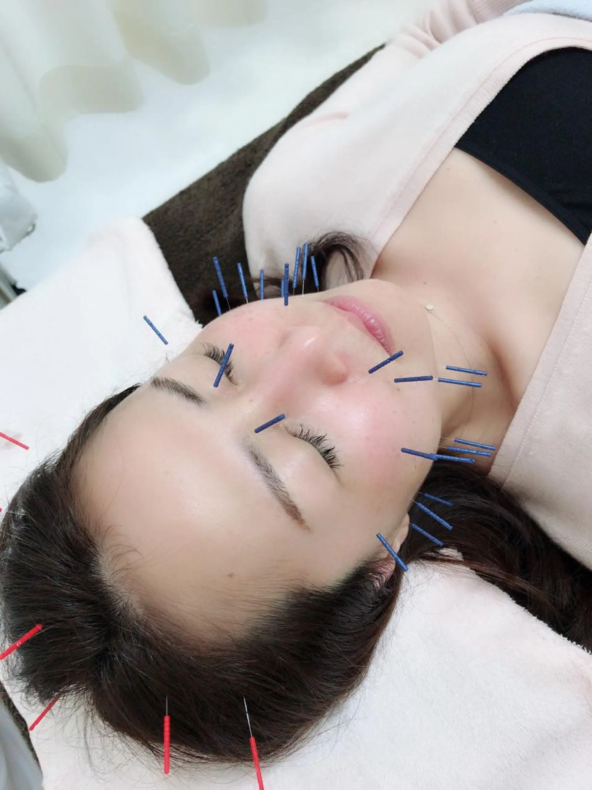 その他 やまだ鍼灸接骨院（やまだしんきゅうせっこついん）所属・山田 晃のエステ・リラクイメージ