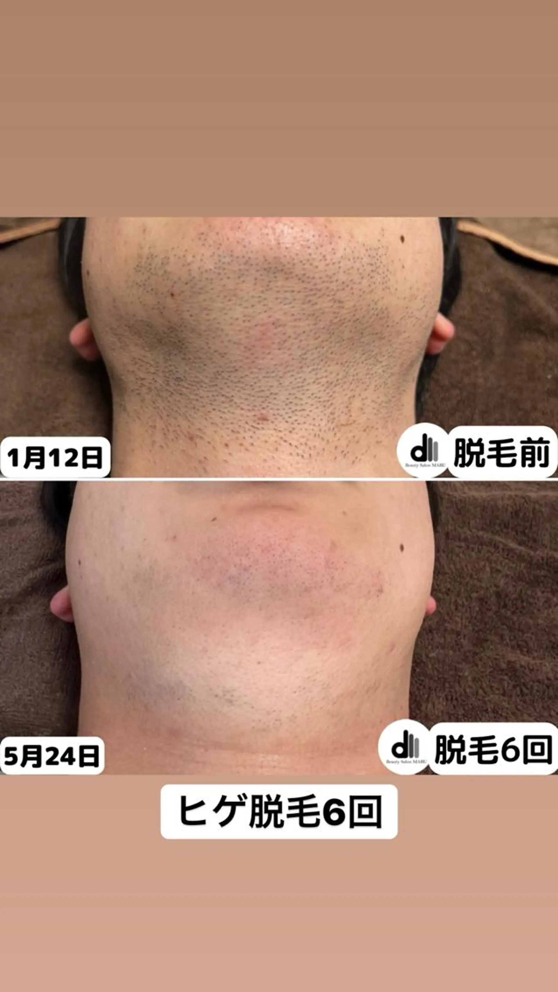 メンズ Beauty Salon MARU所属・新潟市メンズ【脱毛】 MARUのエステ・リラクイメージ