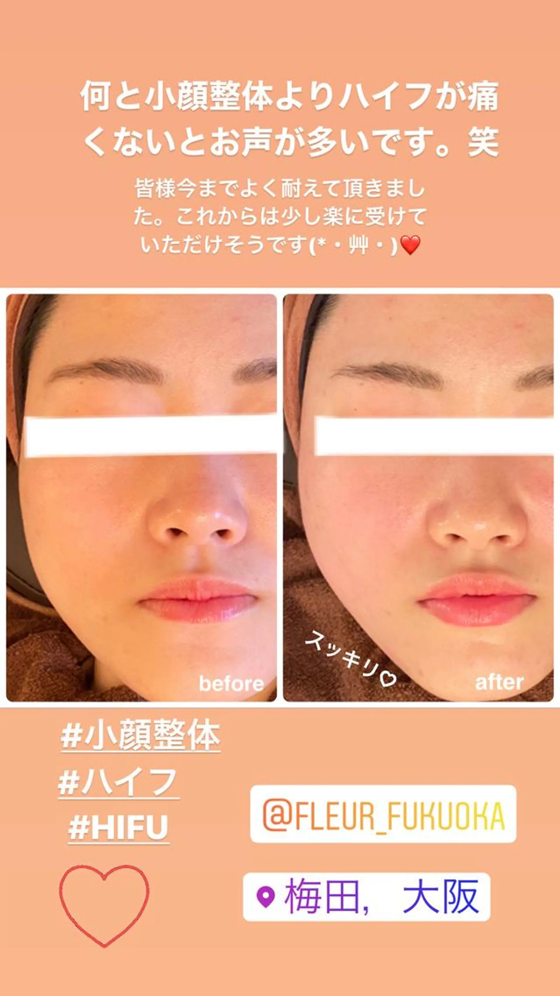 FLEUR大阪・整体 ・ハイフ・痩身・小顔のエステ・リラクイメージ