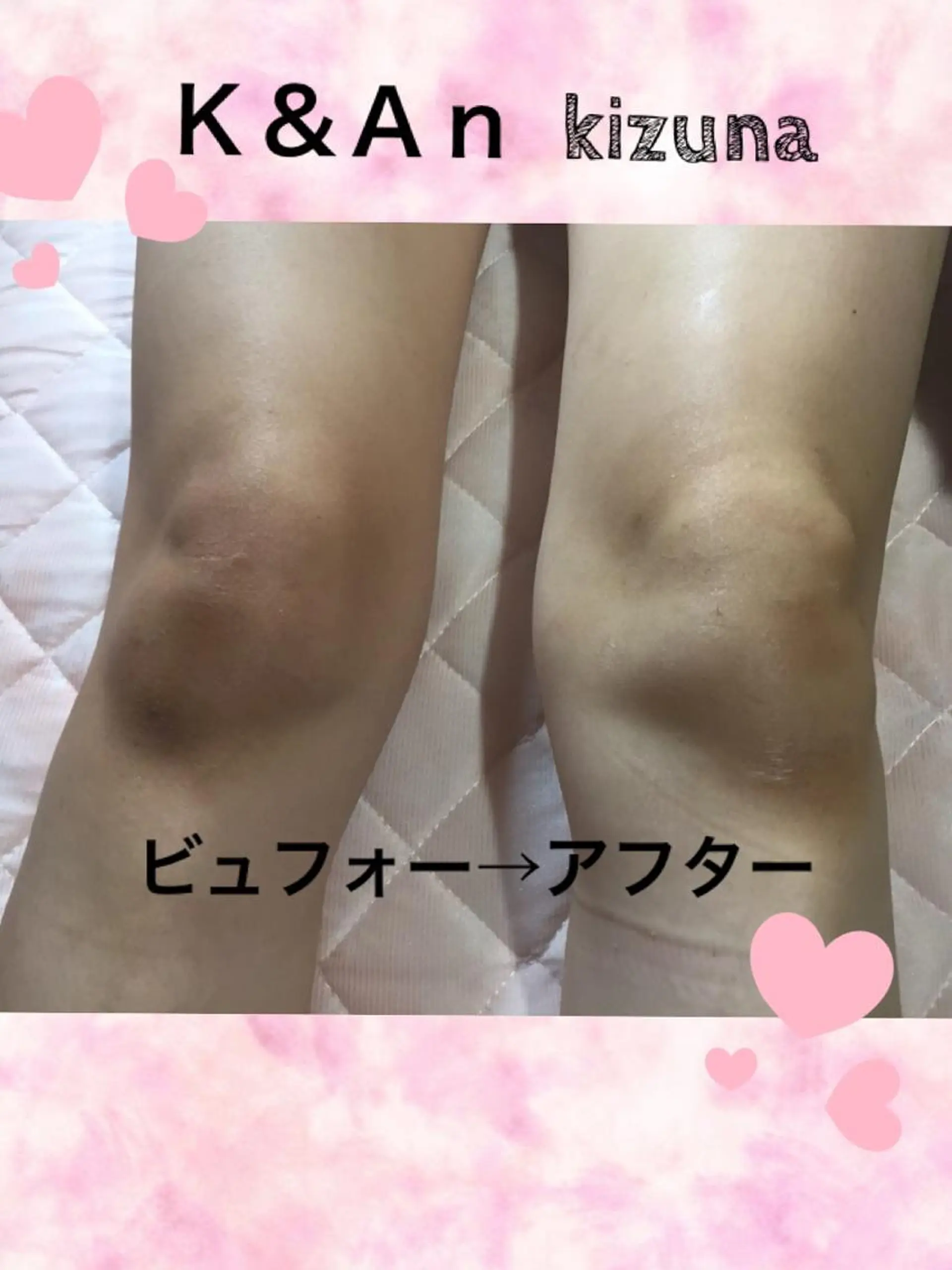エステ K&An kizunaのマツエク・マツパデザイン