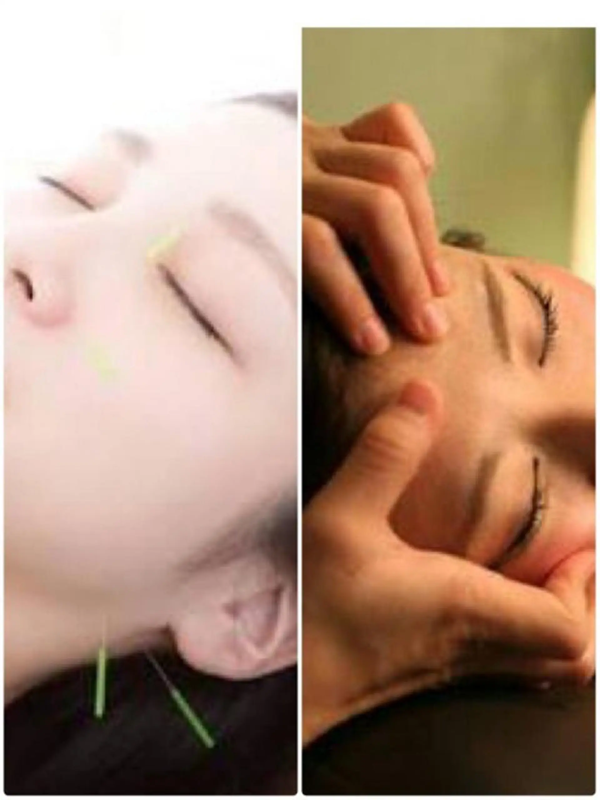 小林整骨院玉川 キジマのエステ・リラクイメージ