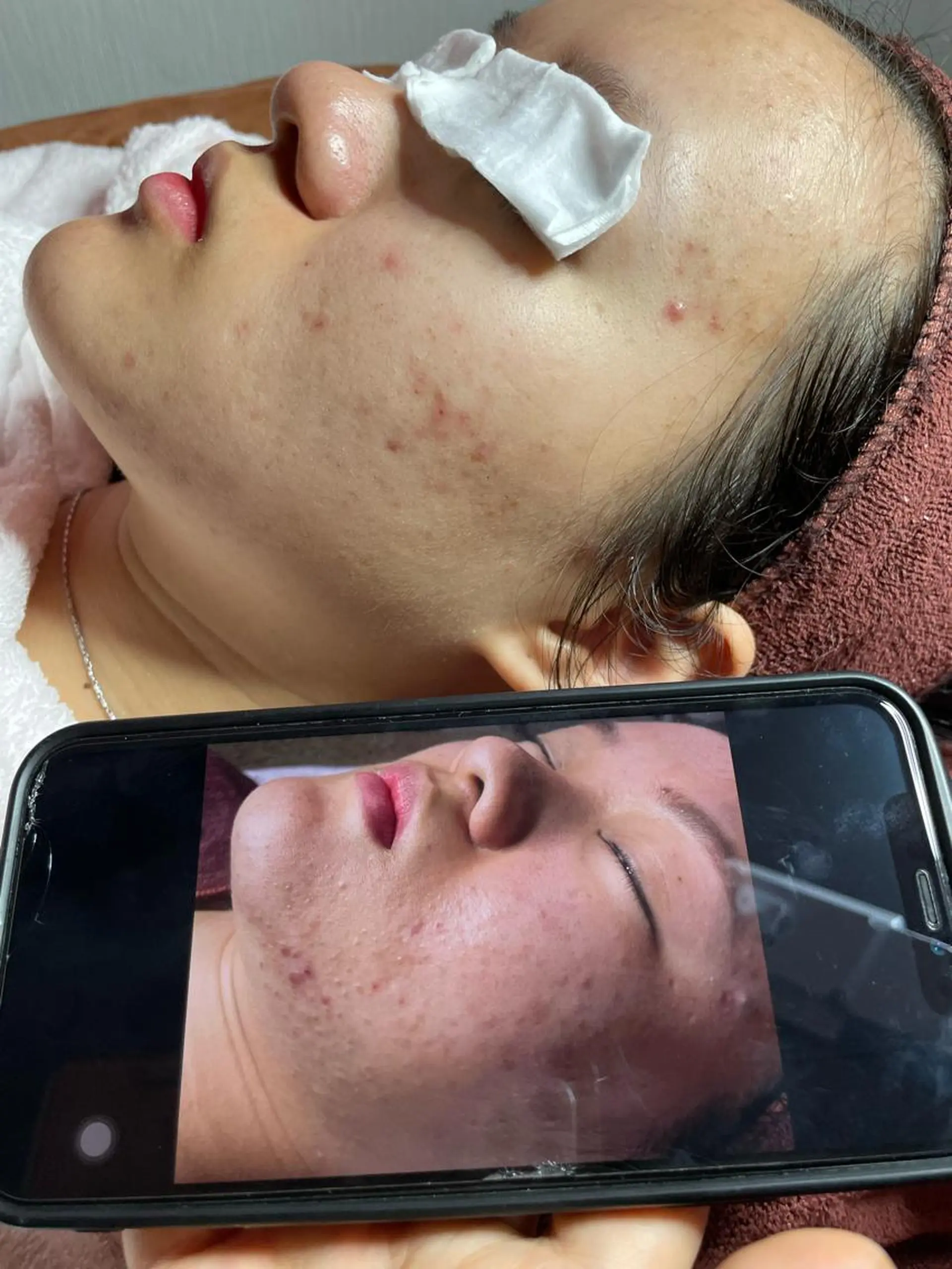 ニキビ、痩身、脱毛、 サクラチャンスパのエステ・リラクイメージ