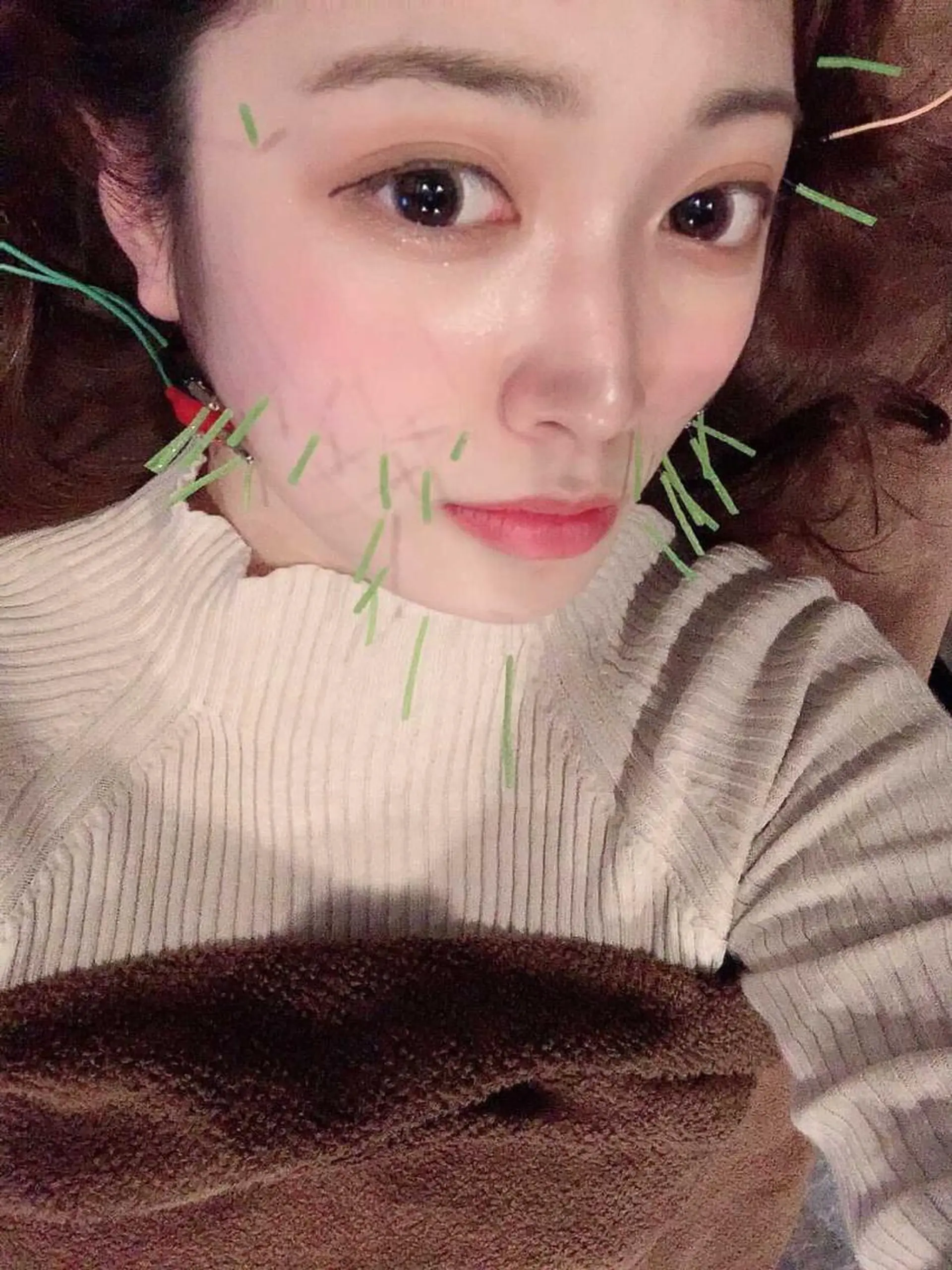 エステ リラク 美容鍼灸サロン LOMIHARIのエステ・リラクイメージ