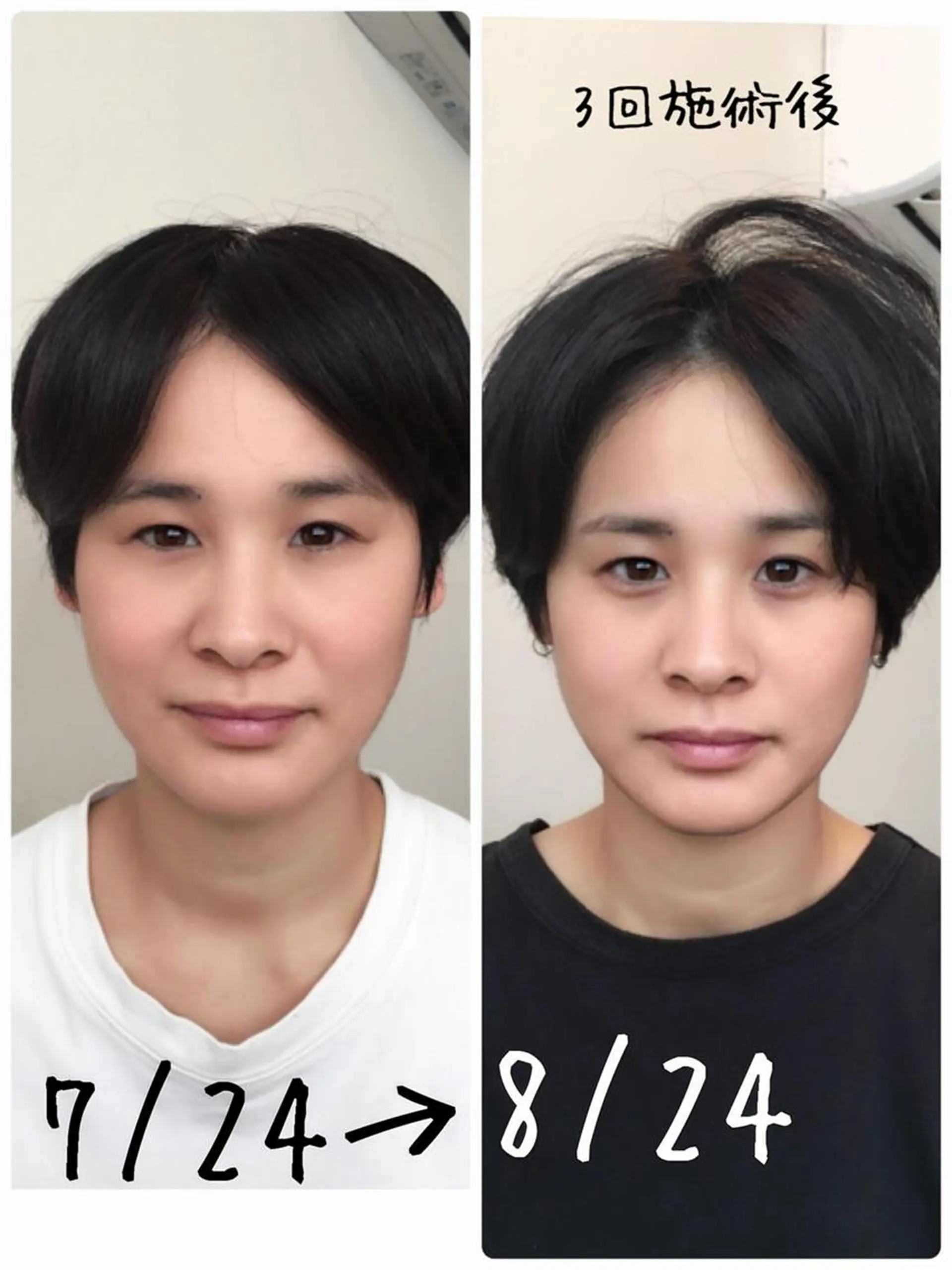 【パーソナル鍼灸】 Pintのエステ・リラクイメージ