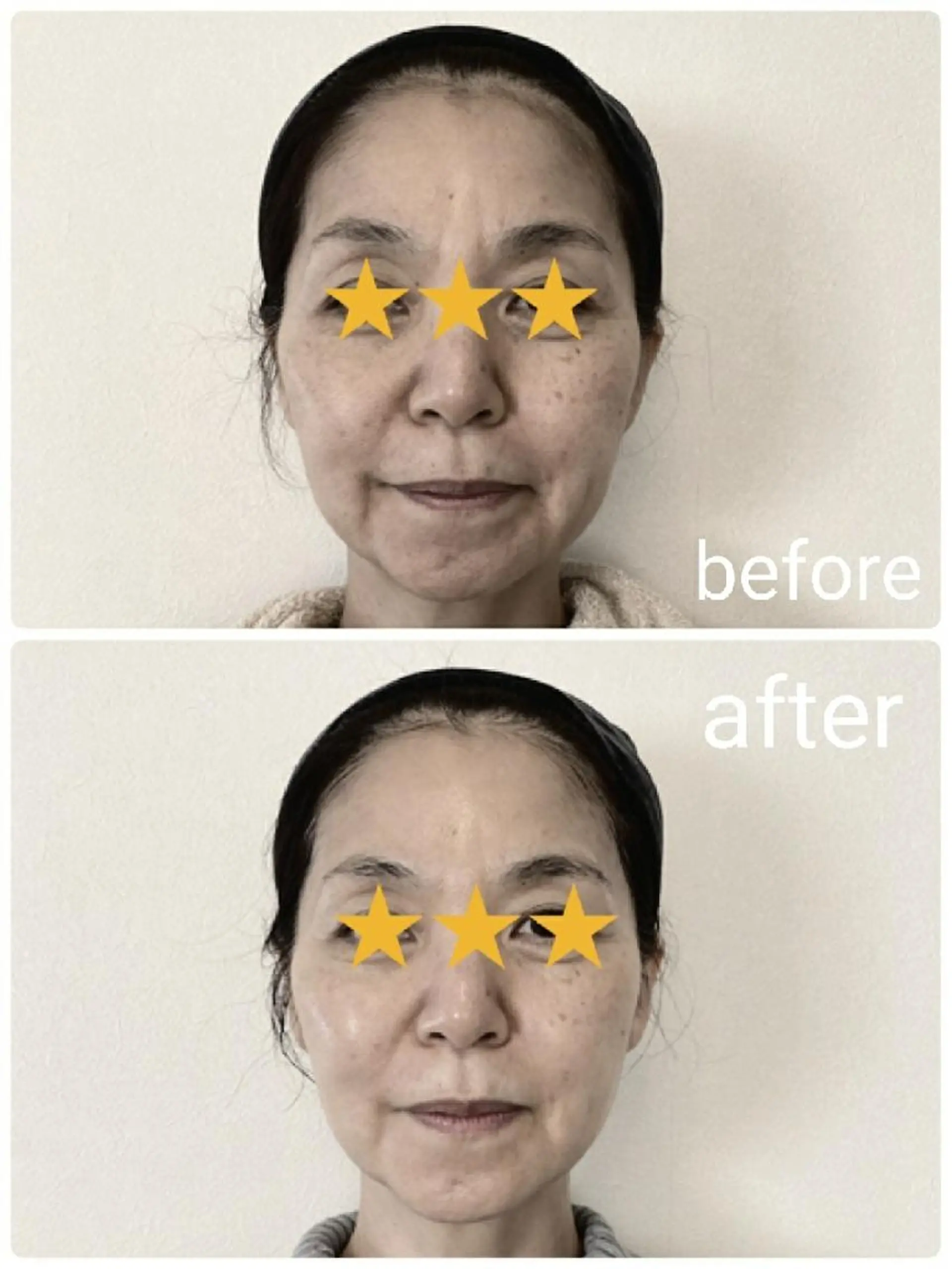  毛穴洗浄・まつ毛 の専門店 ソラーレのエステ・リラクイメージ