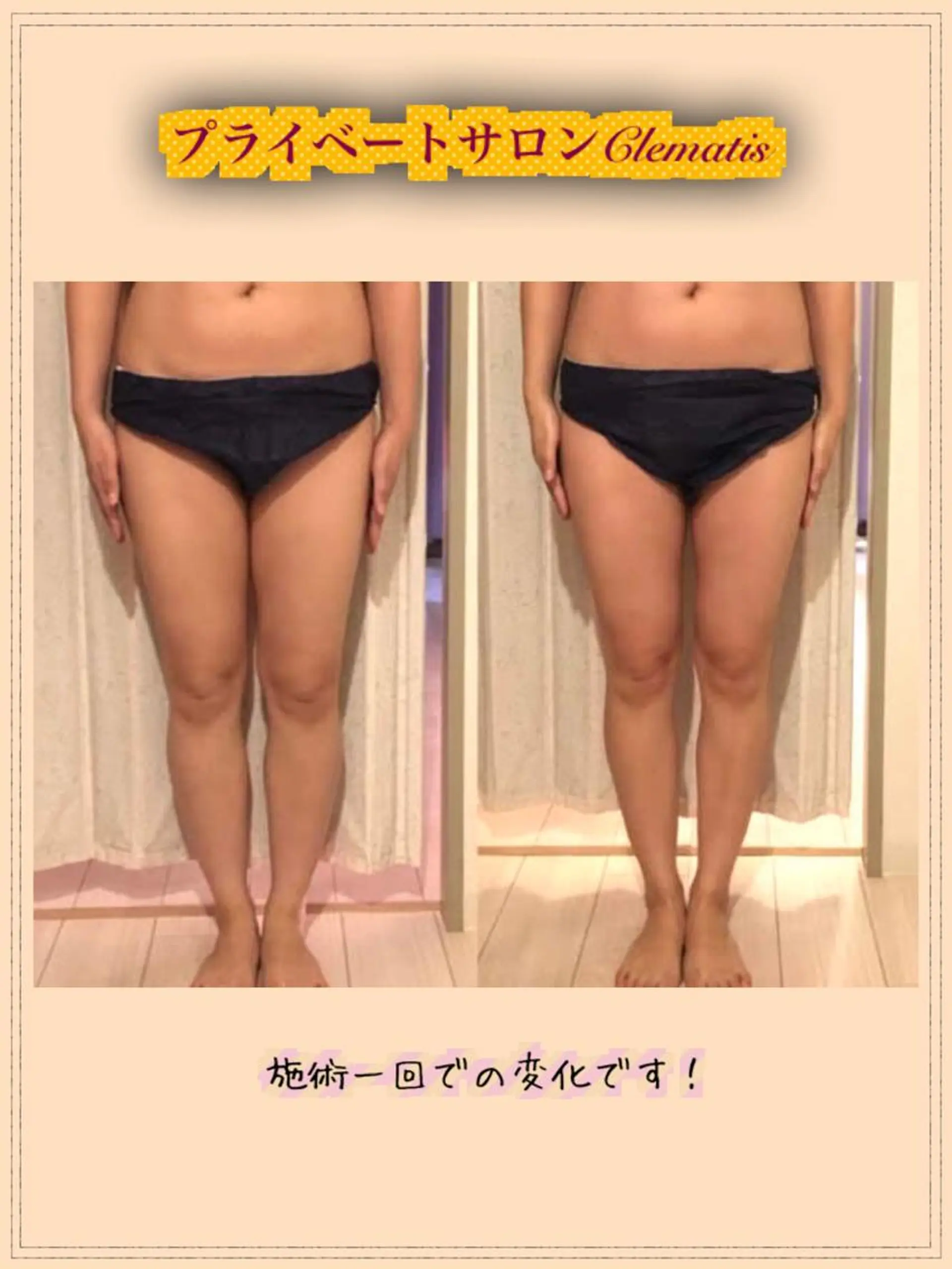 ロング カラー パーマ ヘアアレンジ メンズ キッズ ネイル マツエク・マツパ 強圧オールハンド痩身&黄土よもぎ蒸しプライベートサロンClematis池袋所属・強圧オールハンド痩身 片野のエステ・リラクイメージ