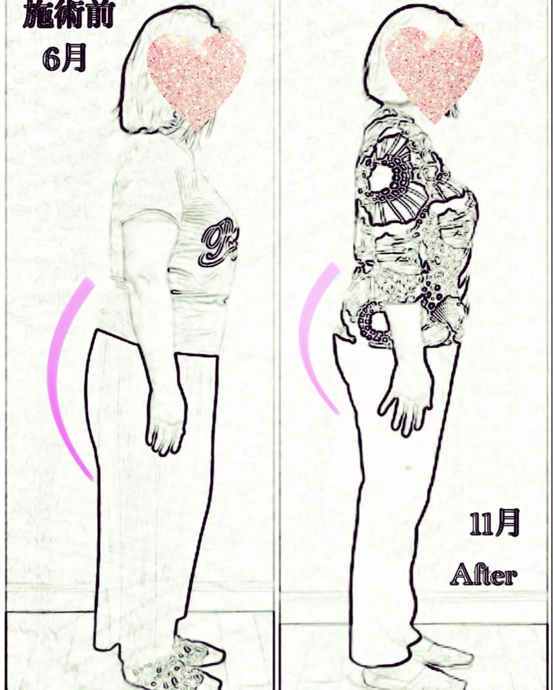 Anne’s happyBonesのエステ・リラクイメージ