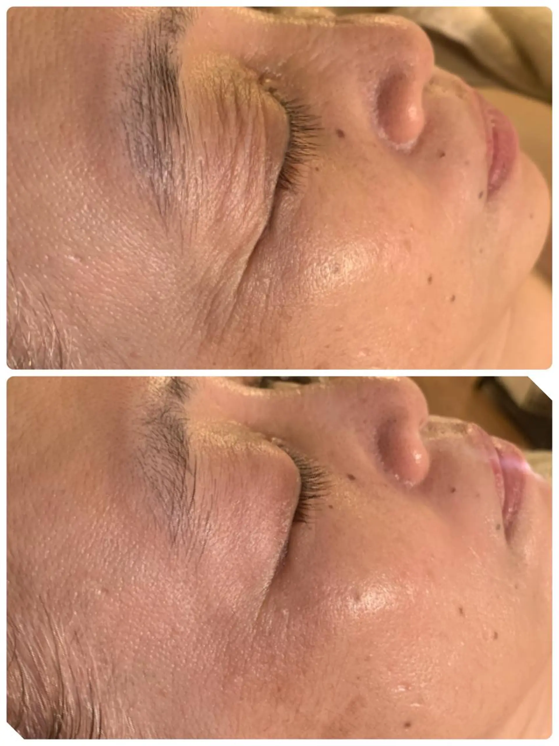 esty hitomiのエステ・リラクイメージ