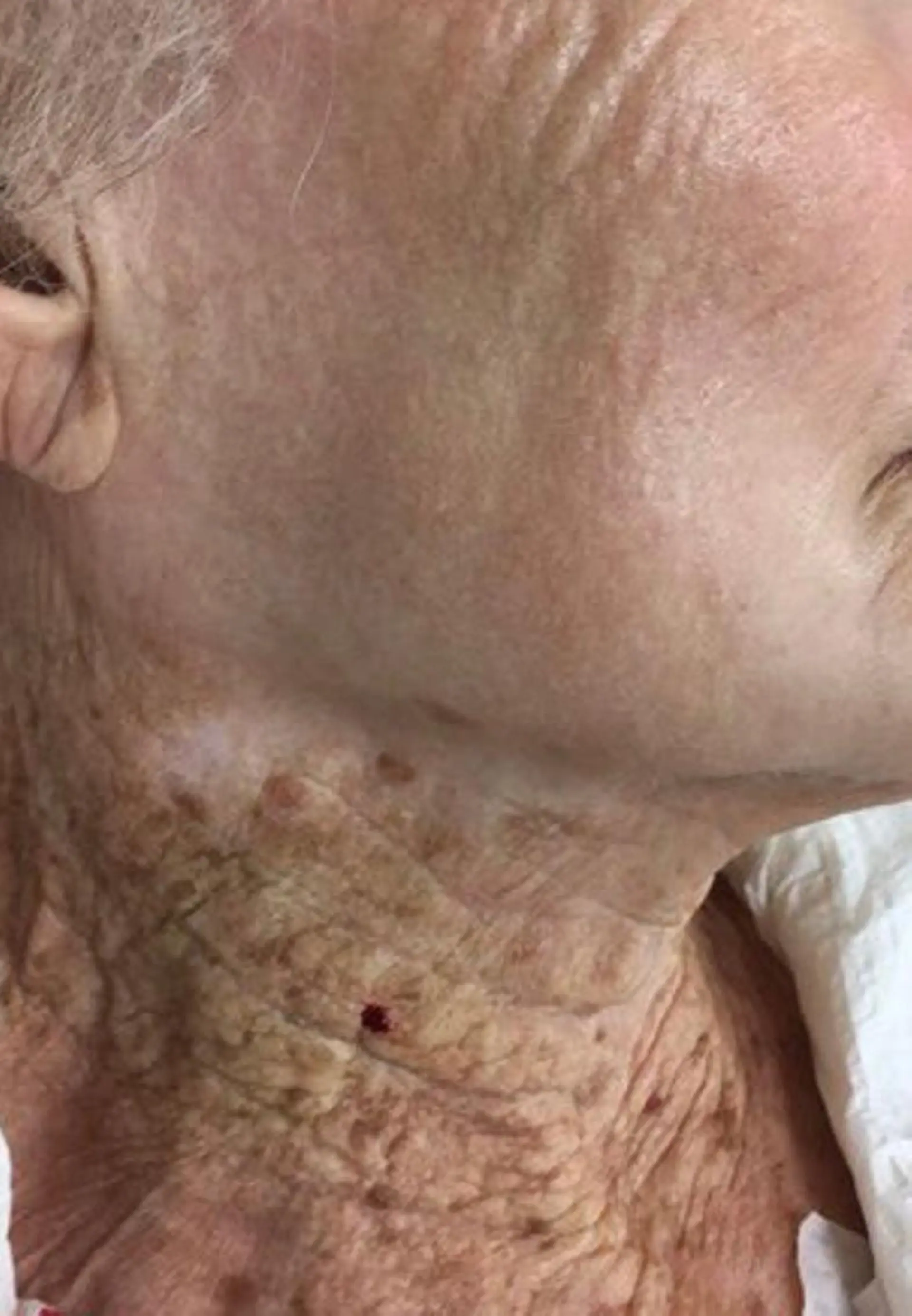 エステ 肌質改善 KALANCHOEのエステ・リラクイメージ