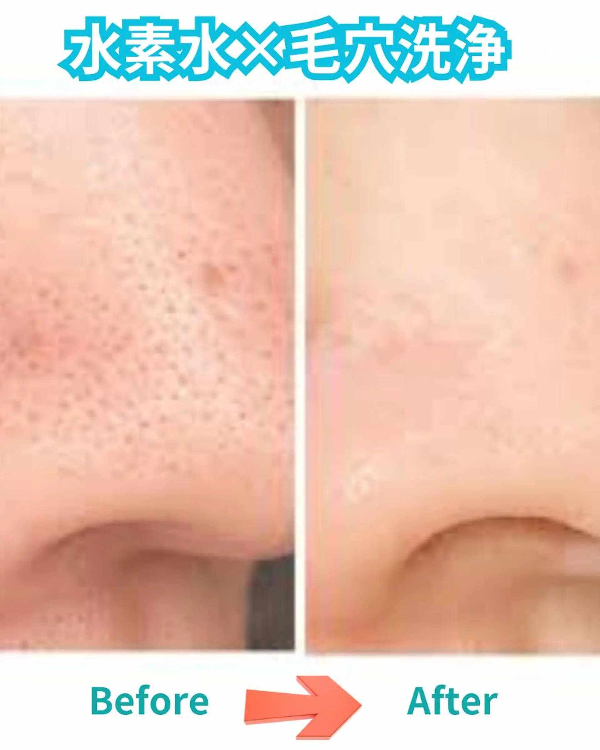 脱毛TWINKLE Shimadaのエステ・リラクイメージ