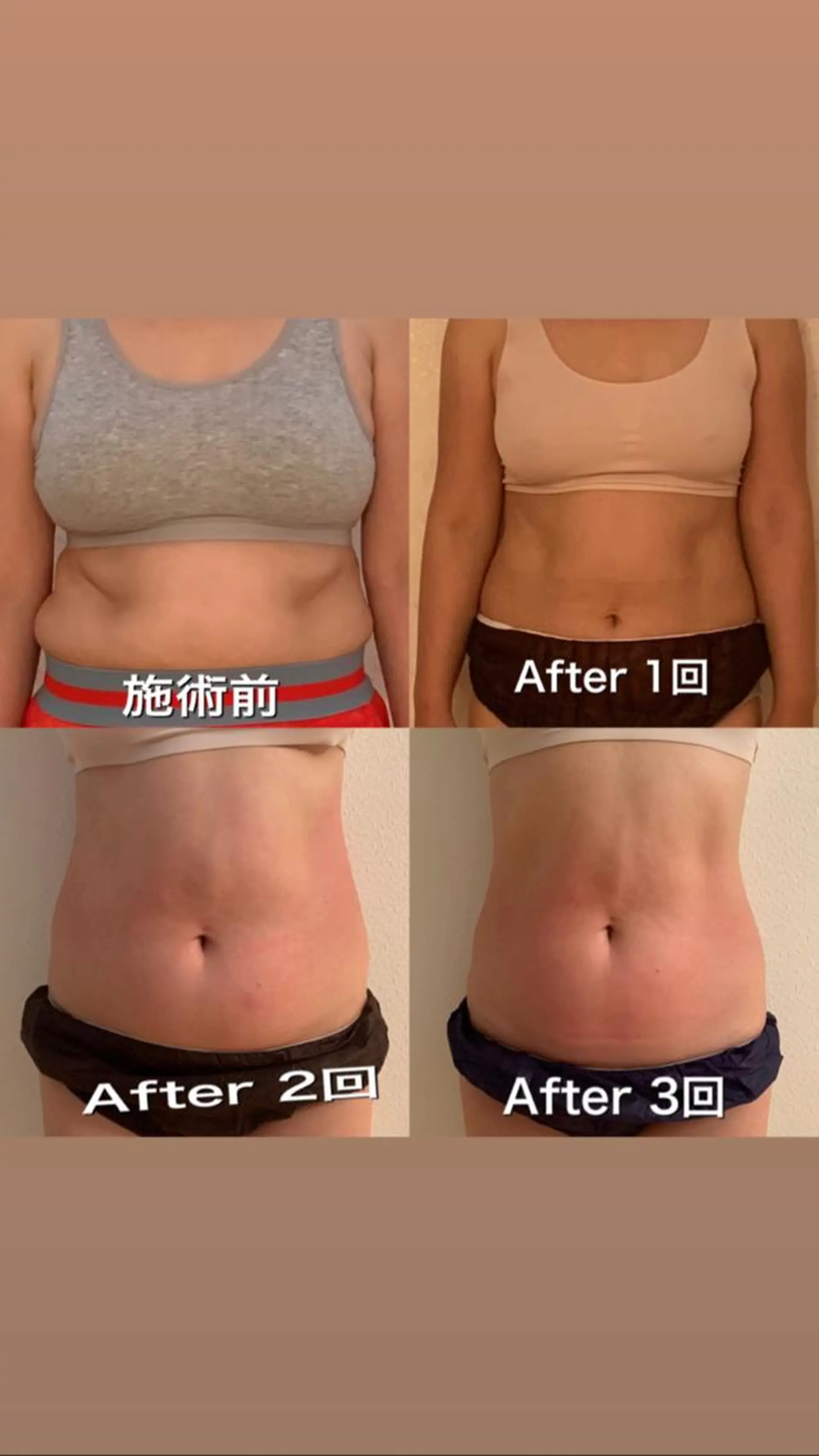 【ハイパーナイフ痩身&小顔コルギ&ハーブピーリング】K-Beauty　東新宿所属・kーbeauty痩身 フェイシャルのエステ・リラクイメージ