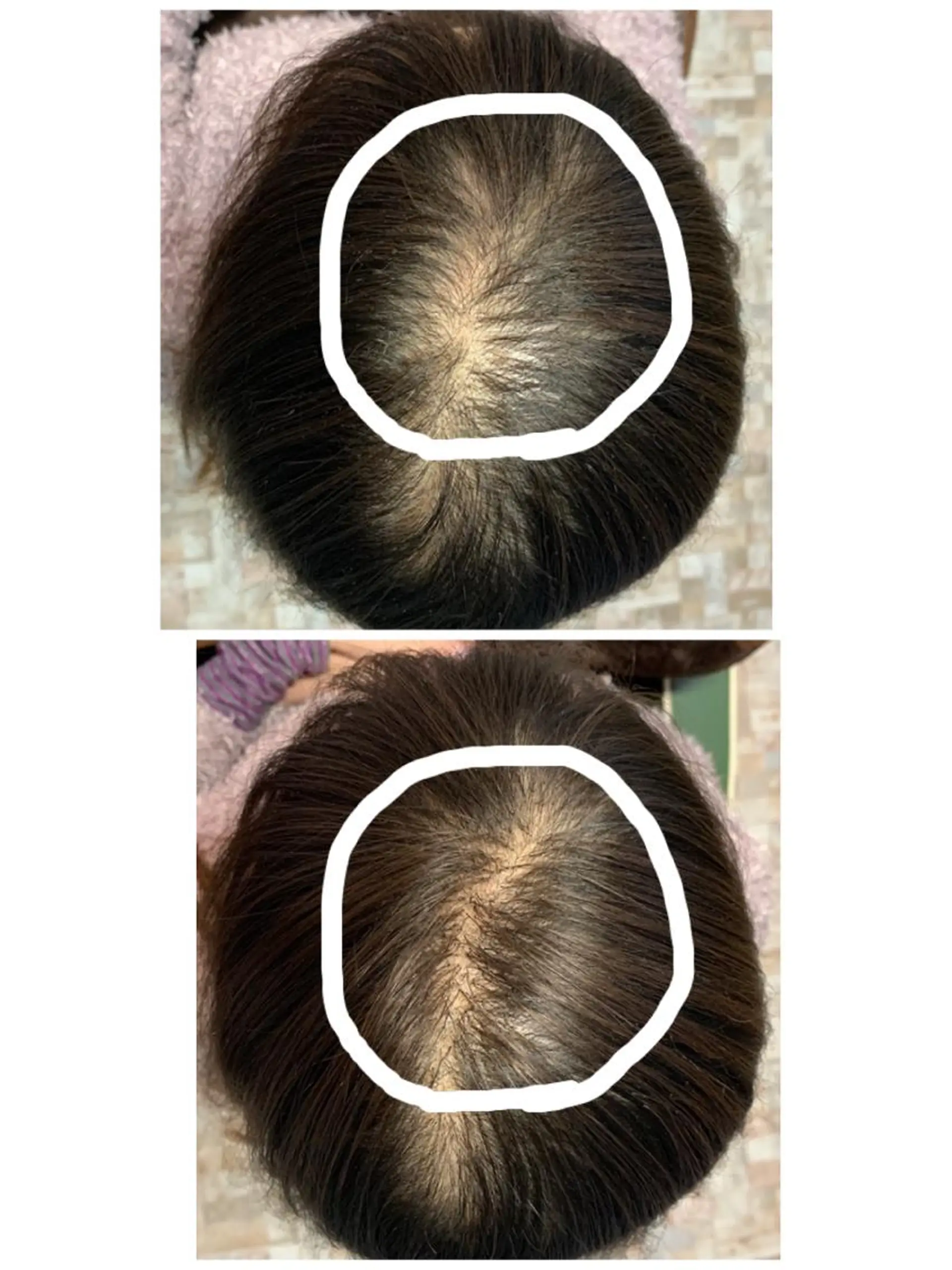 ショート ヘアアレンジ Kanal Kanaのエステ・リラクイメージ