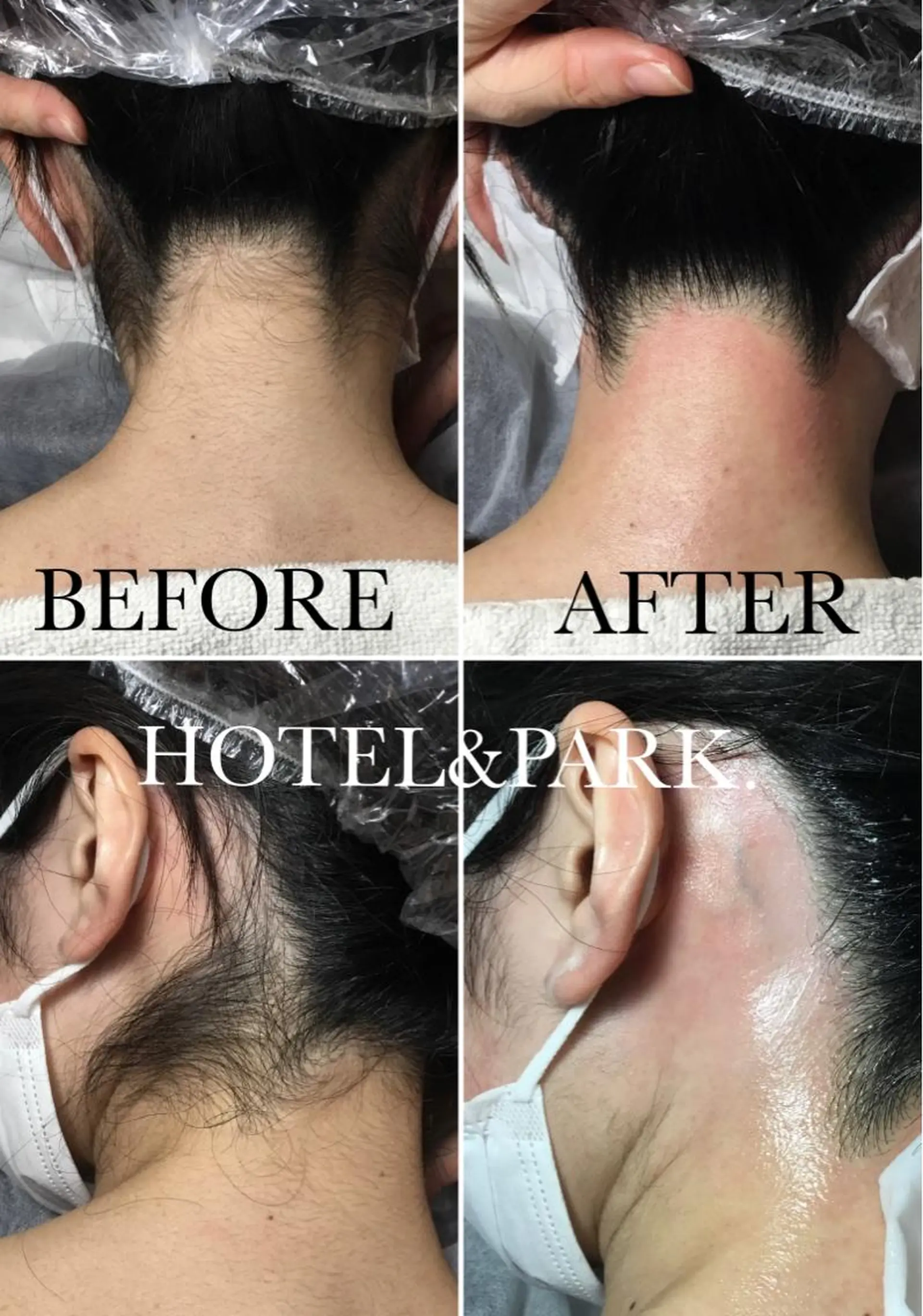 HOTEL&PARK . ワックス脱毛のエステ・リラクイメージ