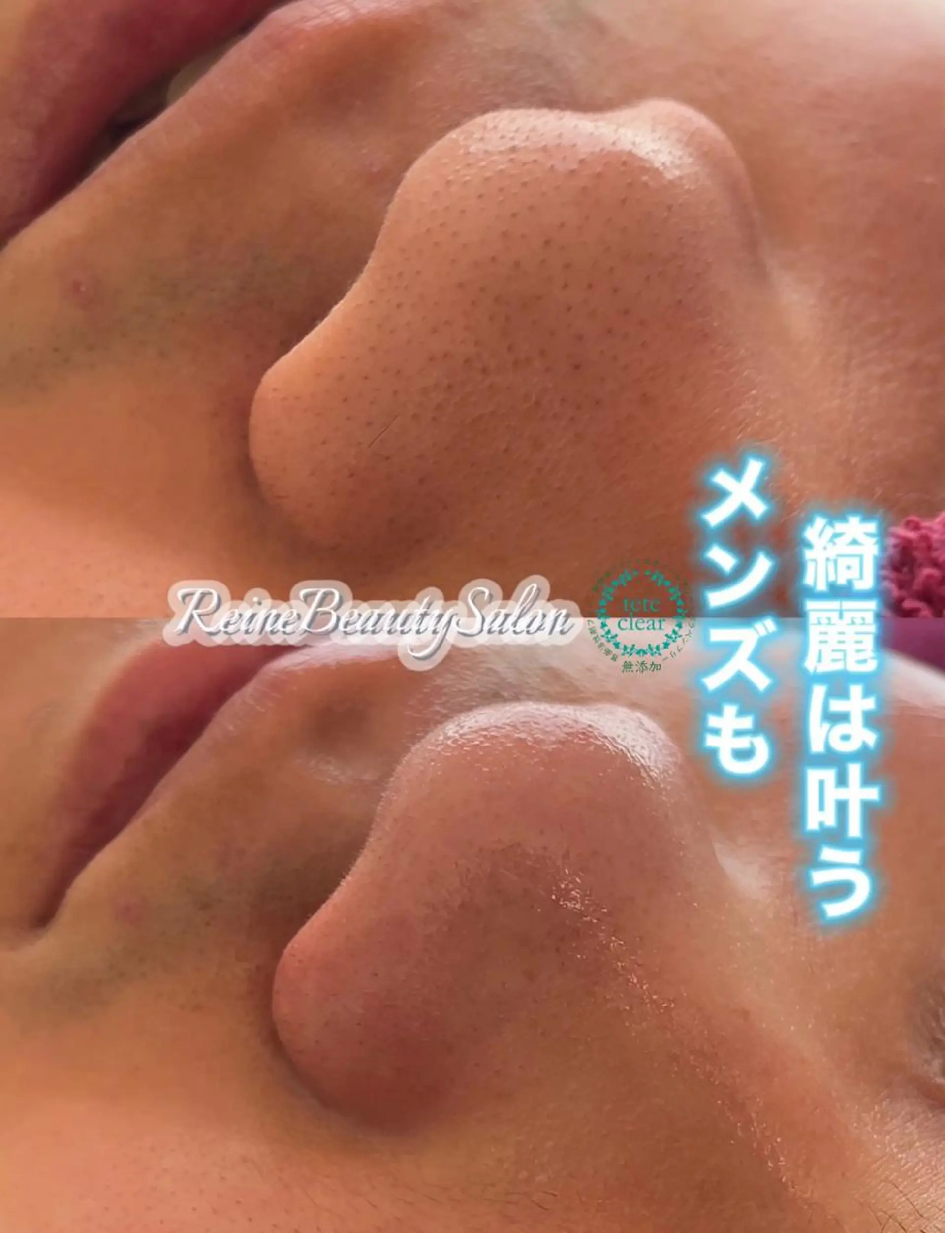 エステ Reine BeautySalon所属・毛穴/シミ肝斑/脱毛 横山梨里のエステ・リラクイメージ