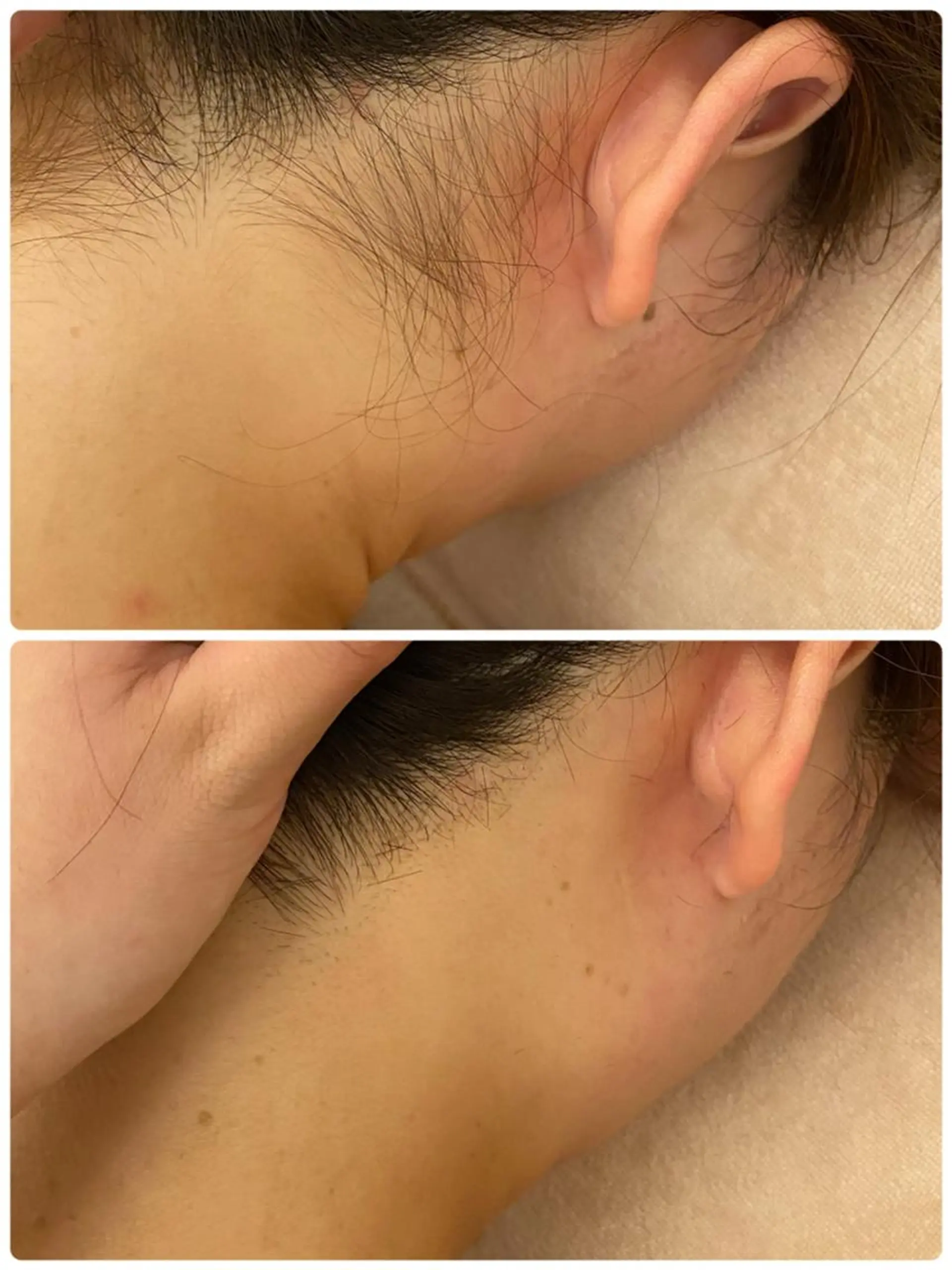 ✨美肌水光✨ アトリエリュバンのエステ・リラクイメージ