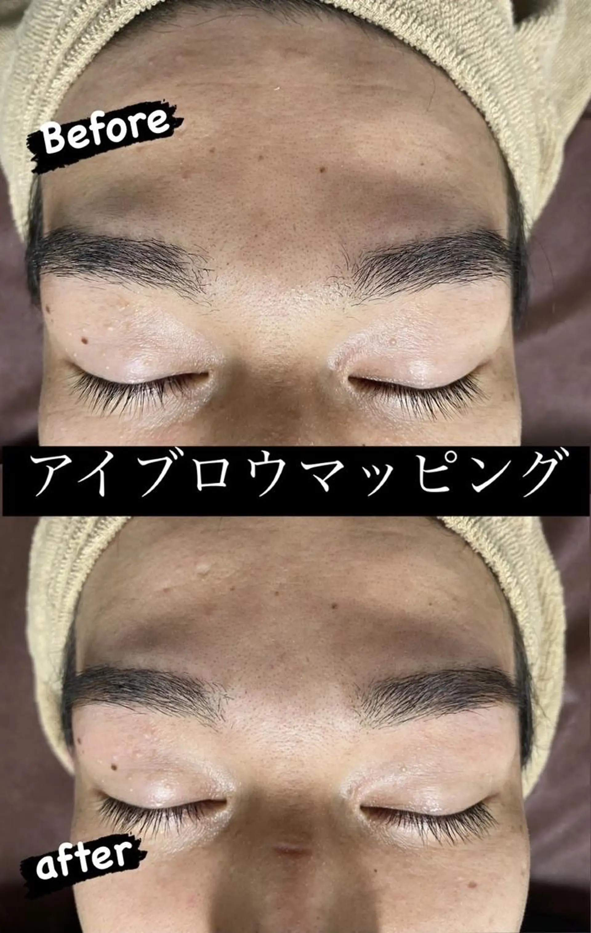 キッズ メンズ ワックス脱毛 Epina 千葉店 【エピナ】のエステ・リラクイメージ