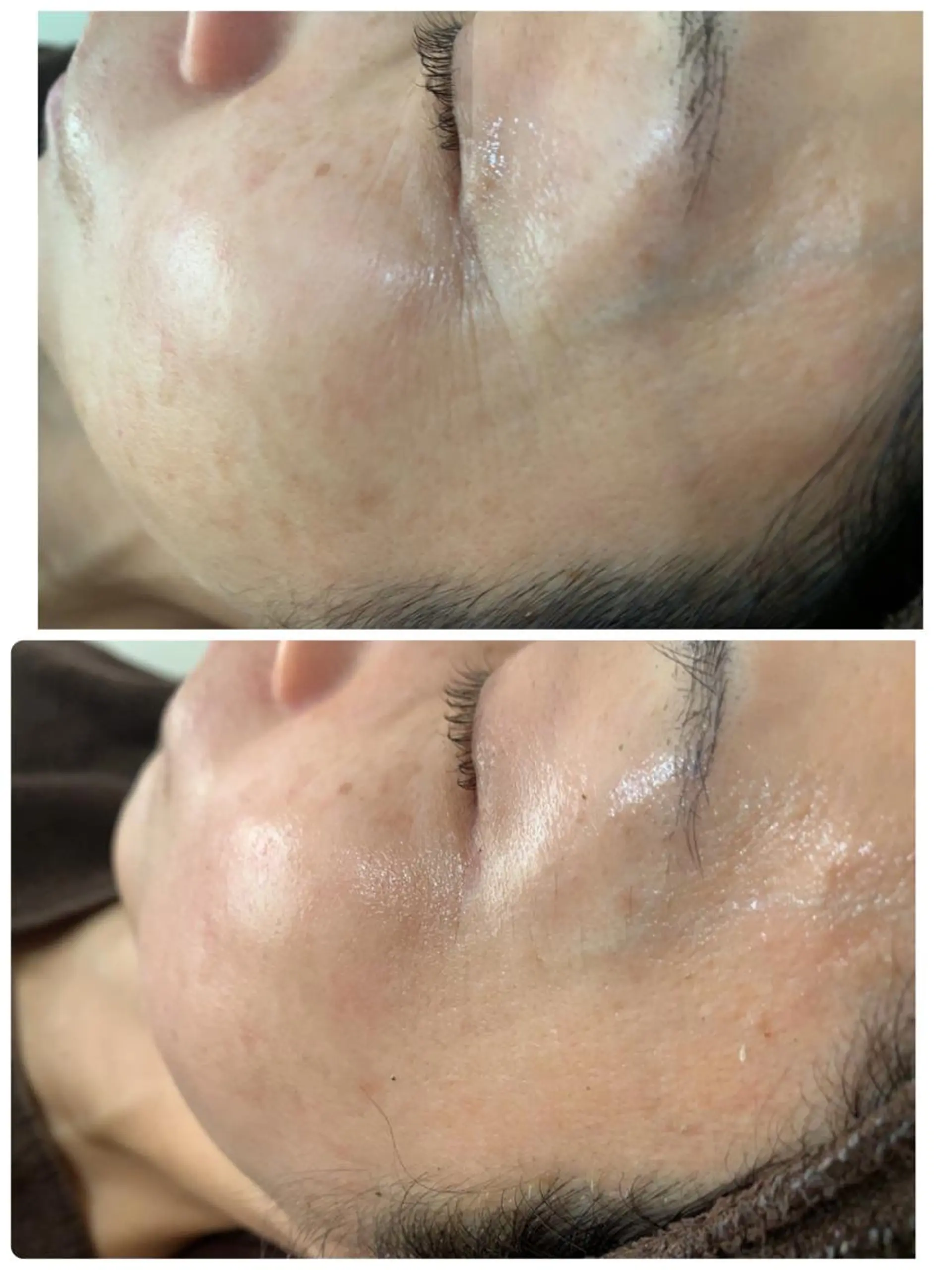 エステ espoir エスポワールのネイルデザイン