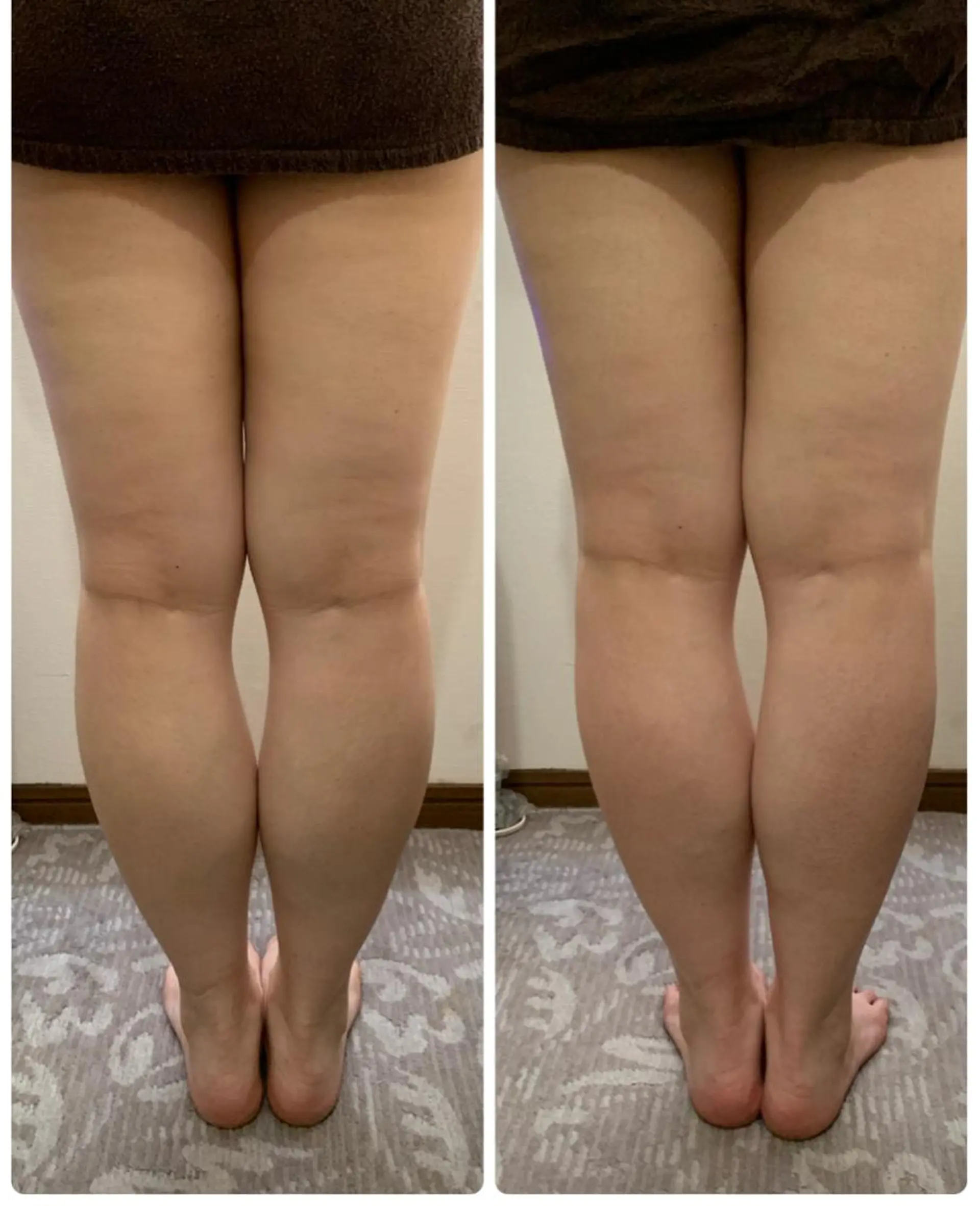 エステ espoir エスポワールのネイルデザイン