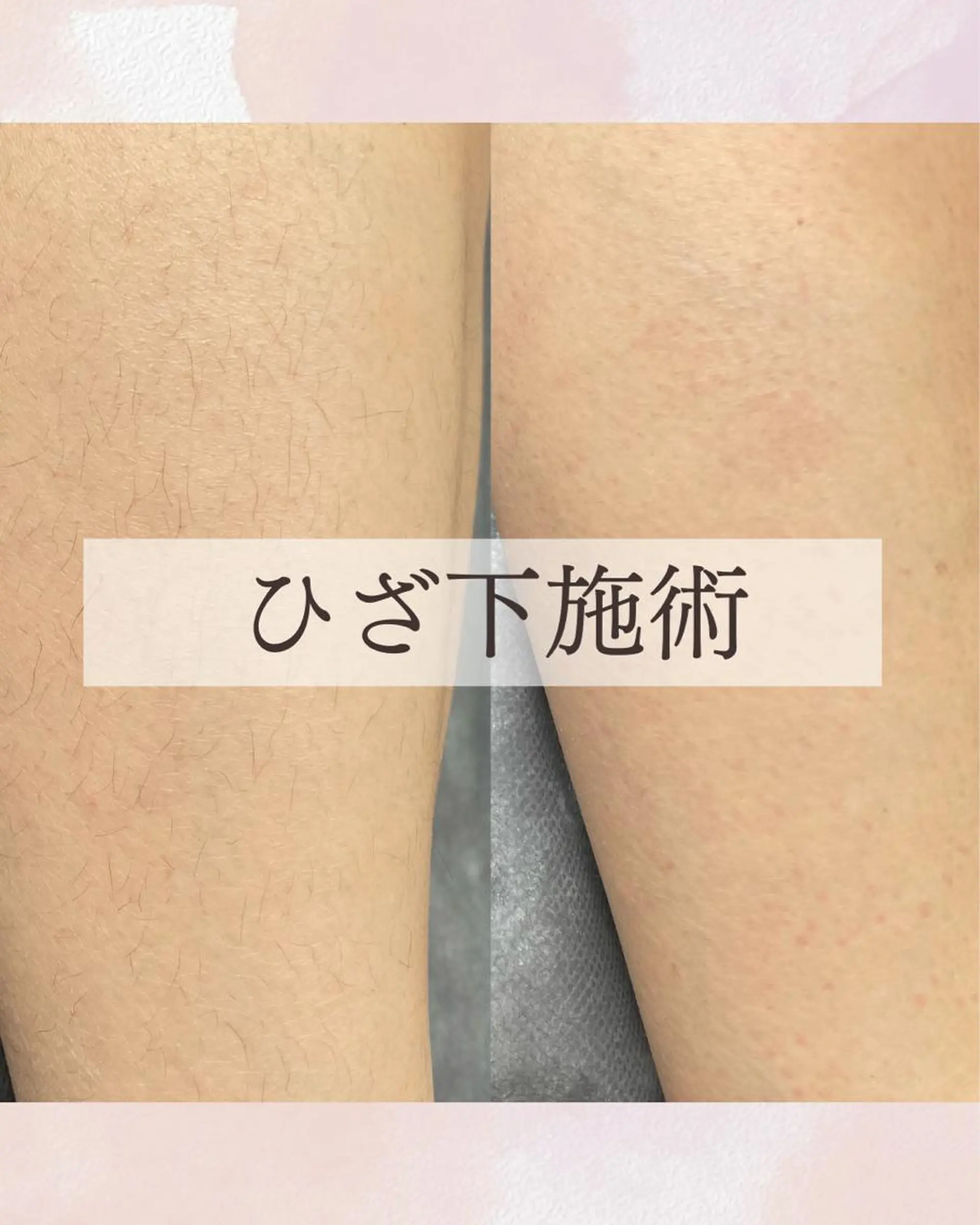 Sugaring Hani Laniのエステ・リラクイメージ