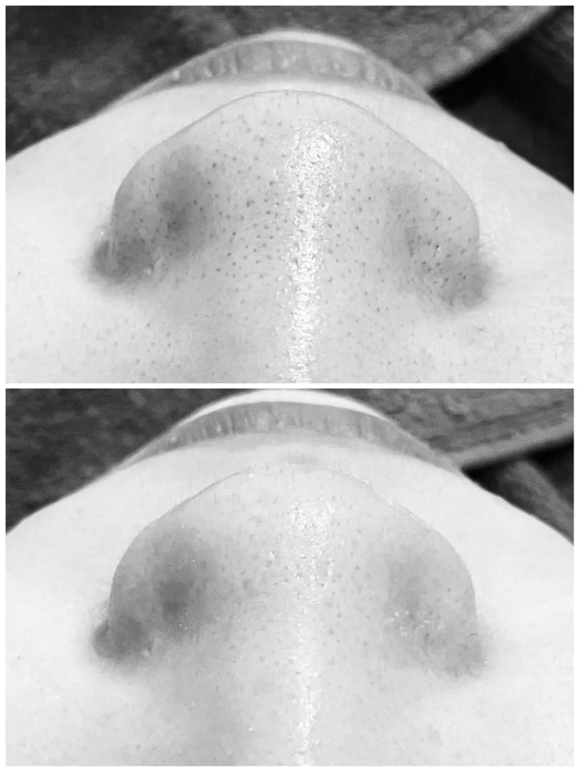 ニキビ跡改善専門🔥 医療にはできない改善のエステ・リラクイメージ