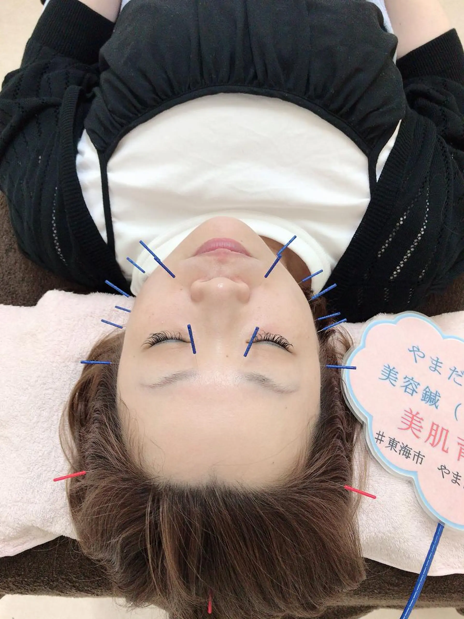 その他 やまだ鍼灸接骨院（やまだしんきゅうせっこついん）所属・山田 晃のエステ・リラクイメージ
