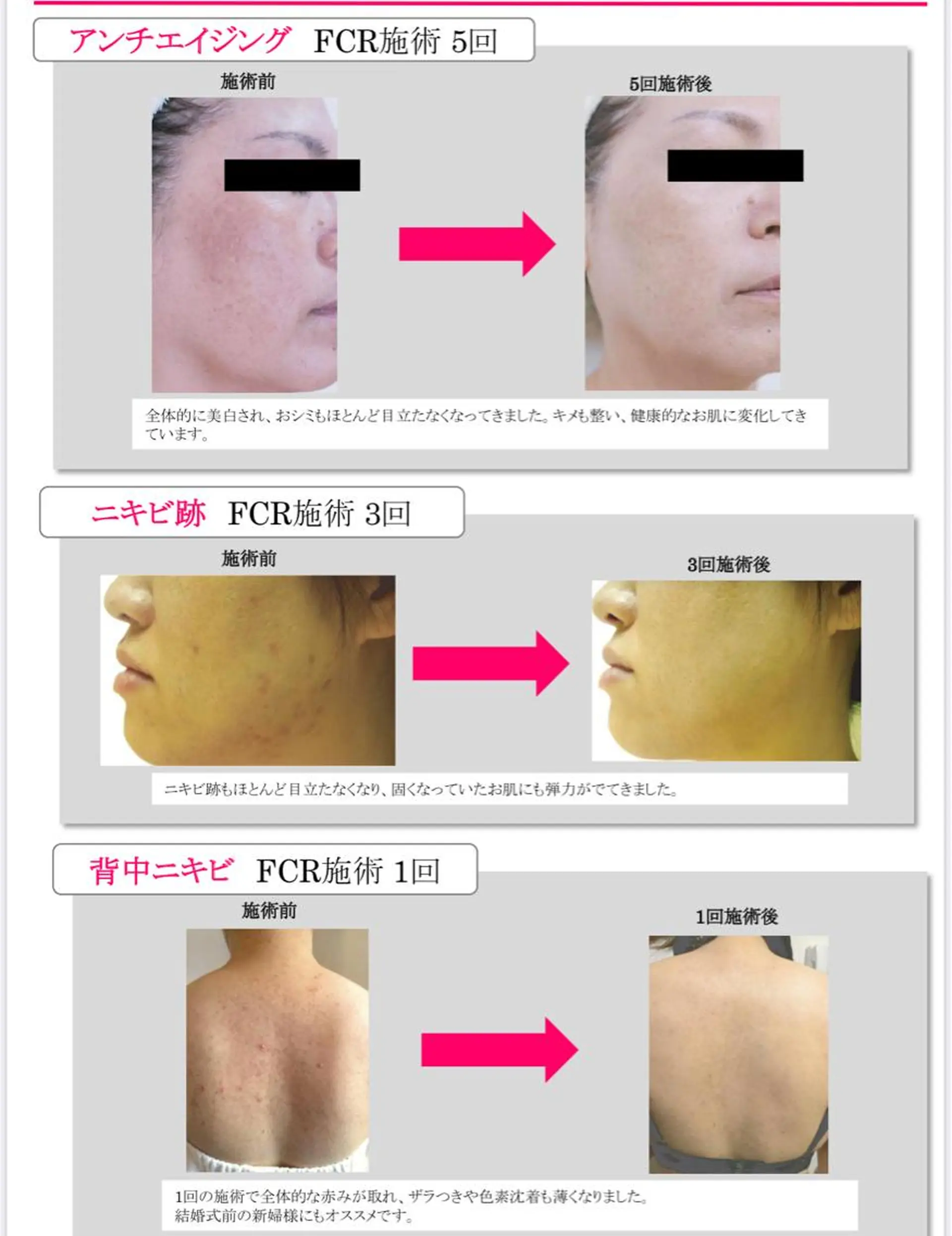 FLEUR大阪・整体 ・ハイフ・痩身・小顔のエステ・リラクイメージ