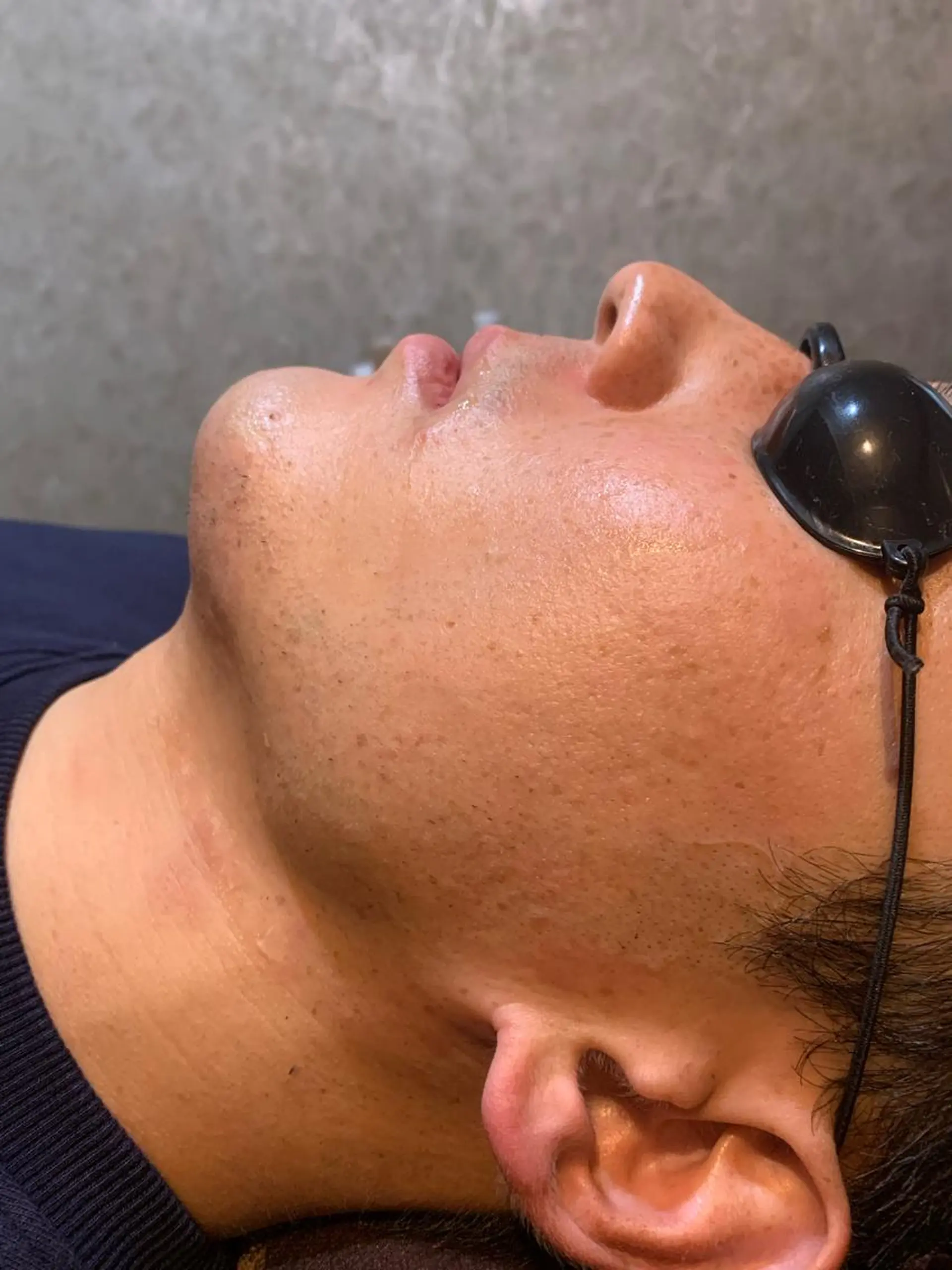 メンズ 20代から始める脱毛 salonLEPIAのエステ・リラクイメージ