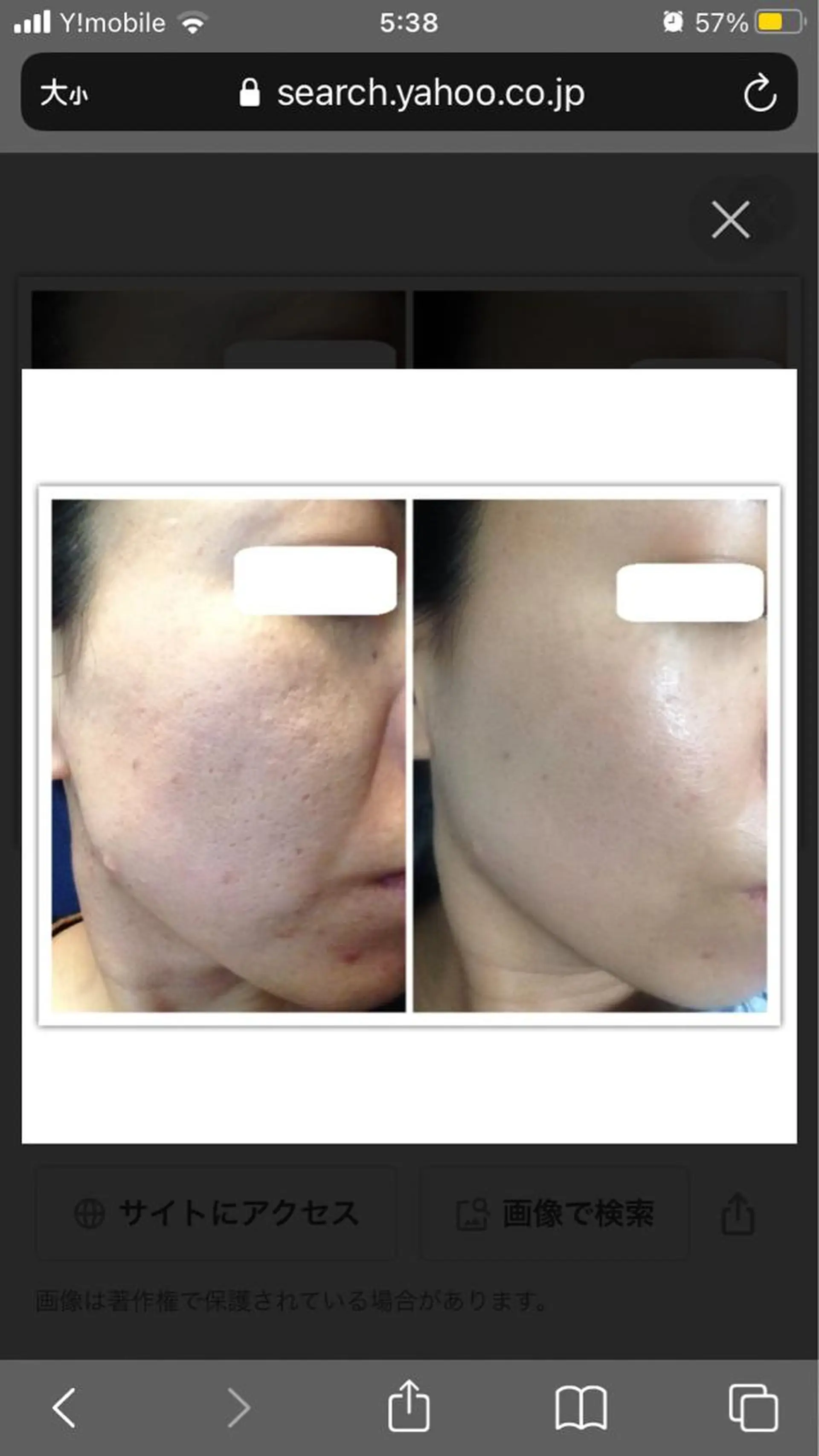 ハーブピーリング専門 🌿モッカのエステ・リラクイメージ