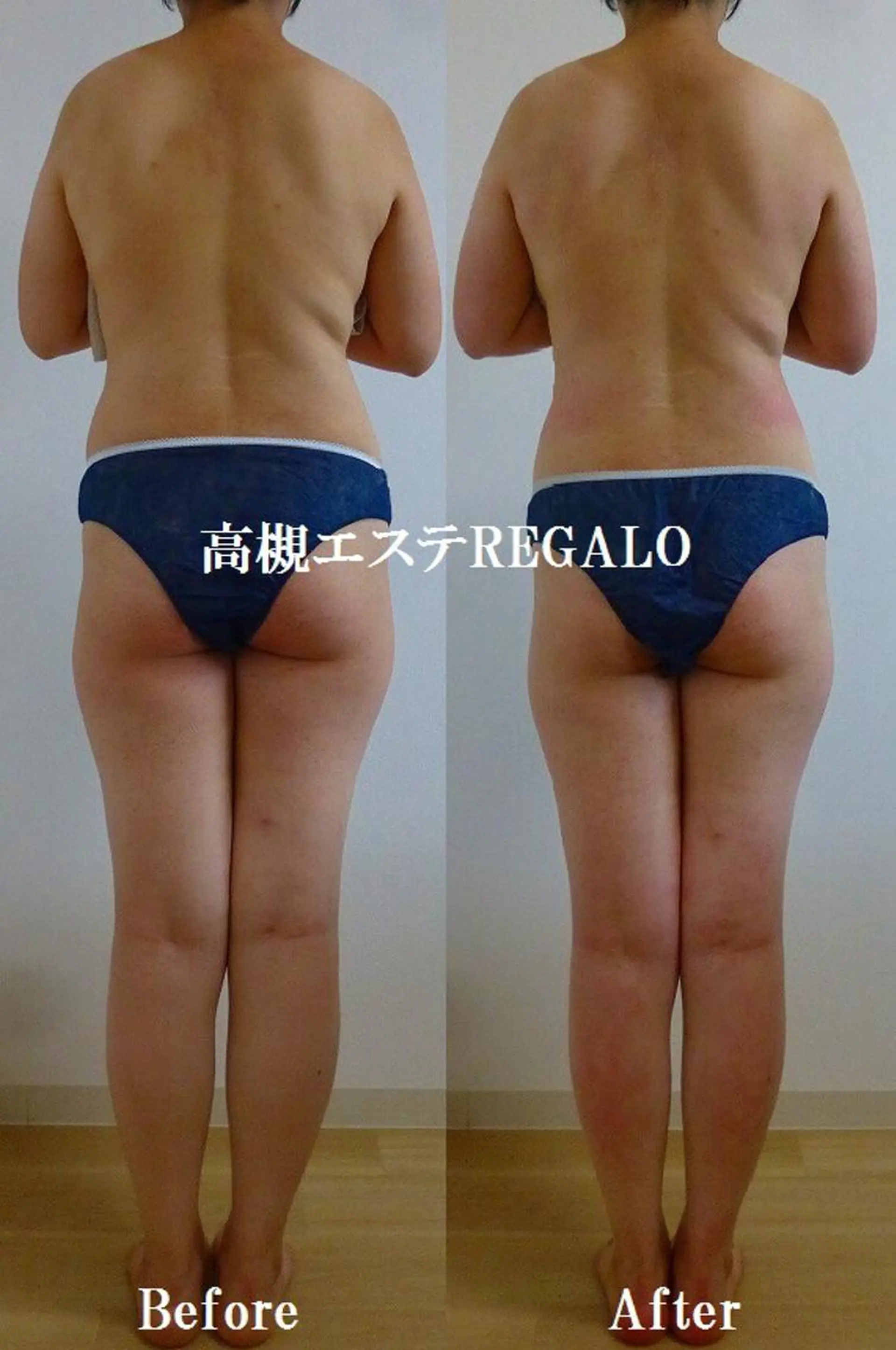 エステ REGALO所属・矢野 さやかのエステ・リラクイメージ